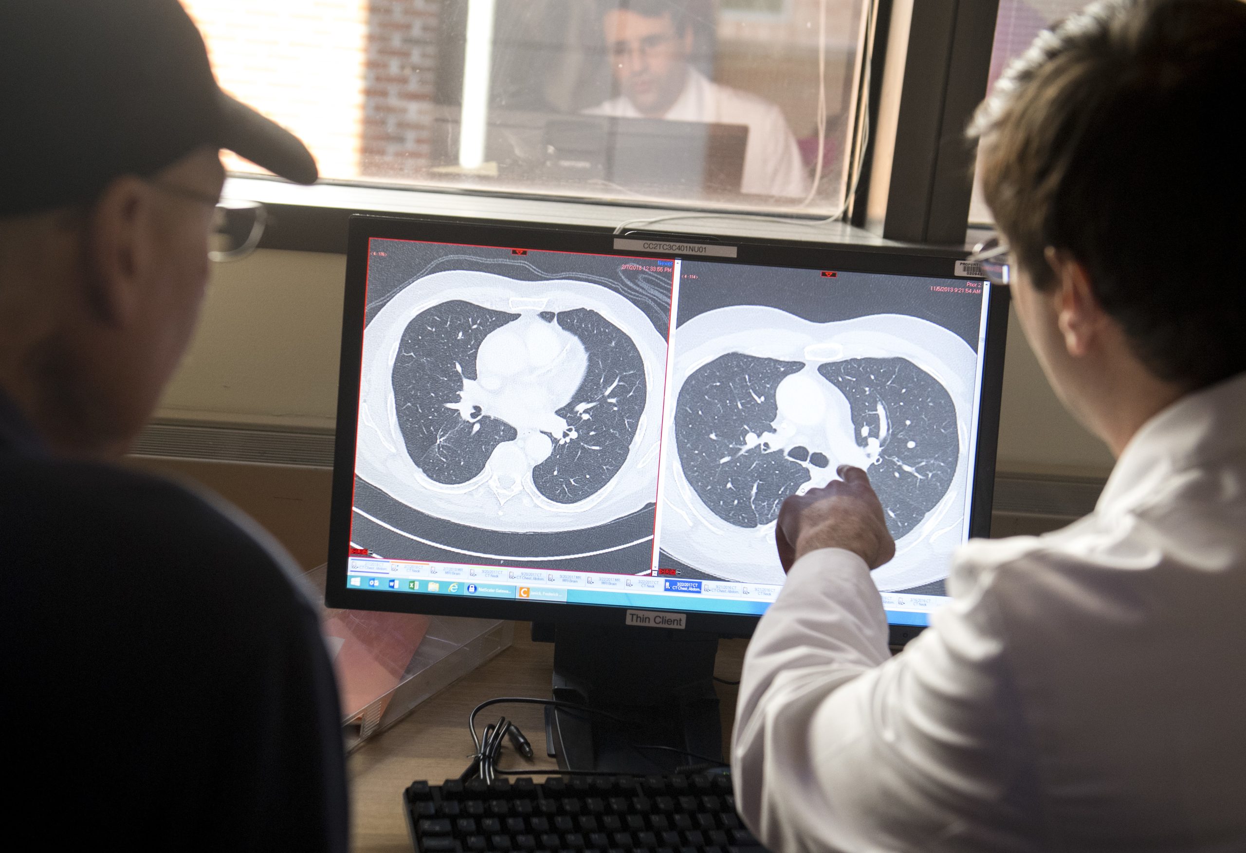 Cancro colorretal está a aumentar entre adultos mais jovens. Como se proteger?