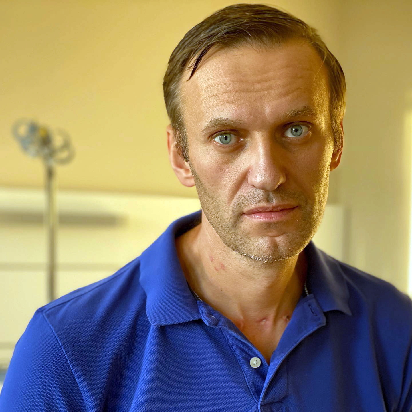 Caso Navalny: Polícia russa diz que doença do opositor se deveu a “pancreatite”