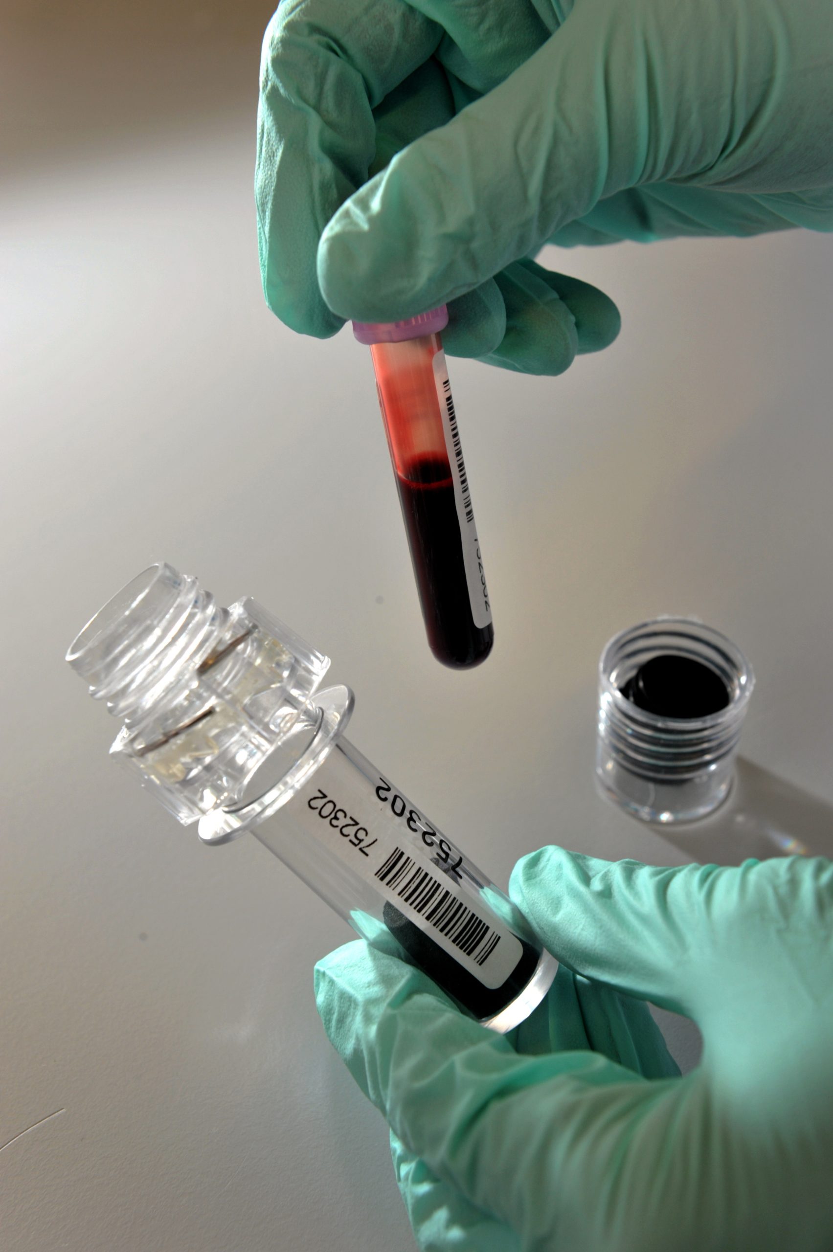 Estudo desvenda possível explicação para cancro do sangue raro em crianças