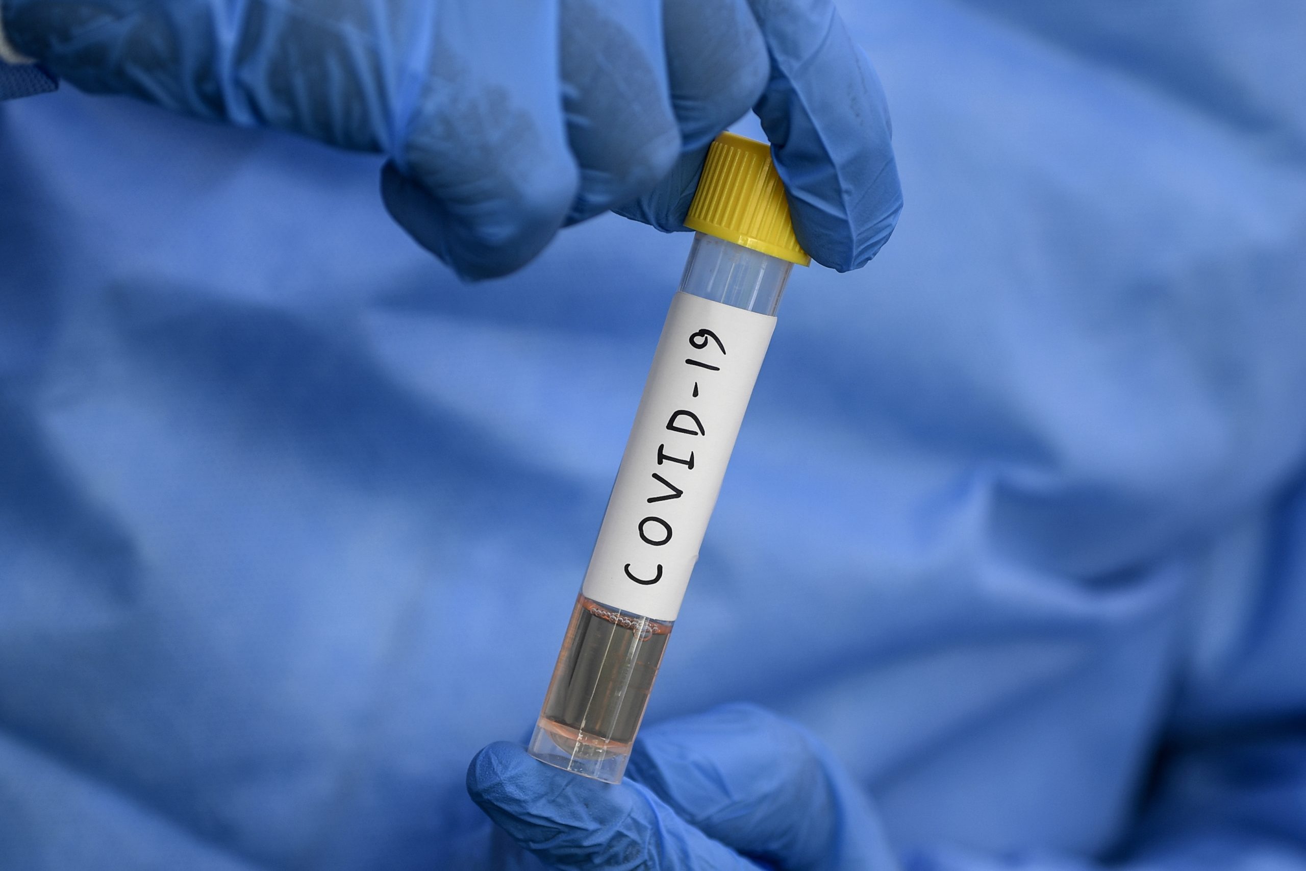 Covid-19. Investigadores não apoiam uso da hidroxicloroquina como tratamento