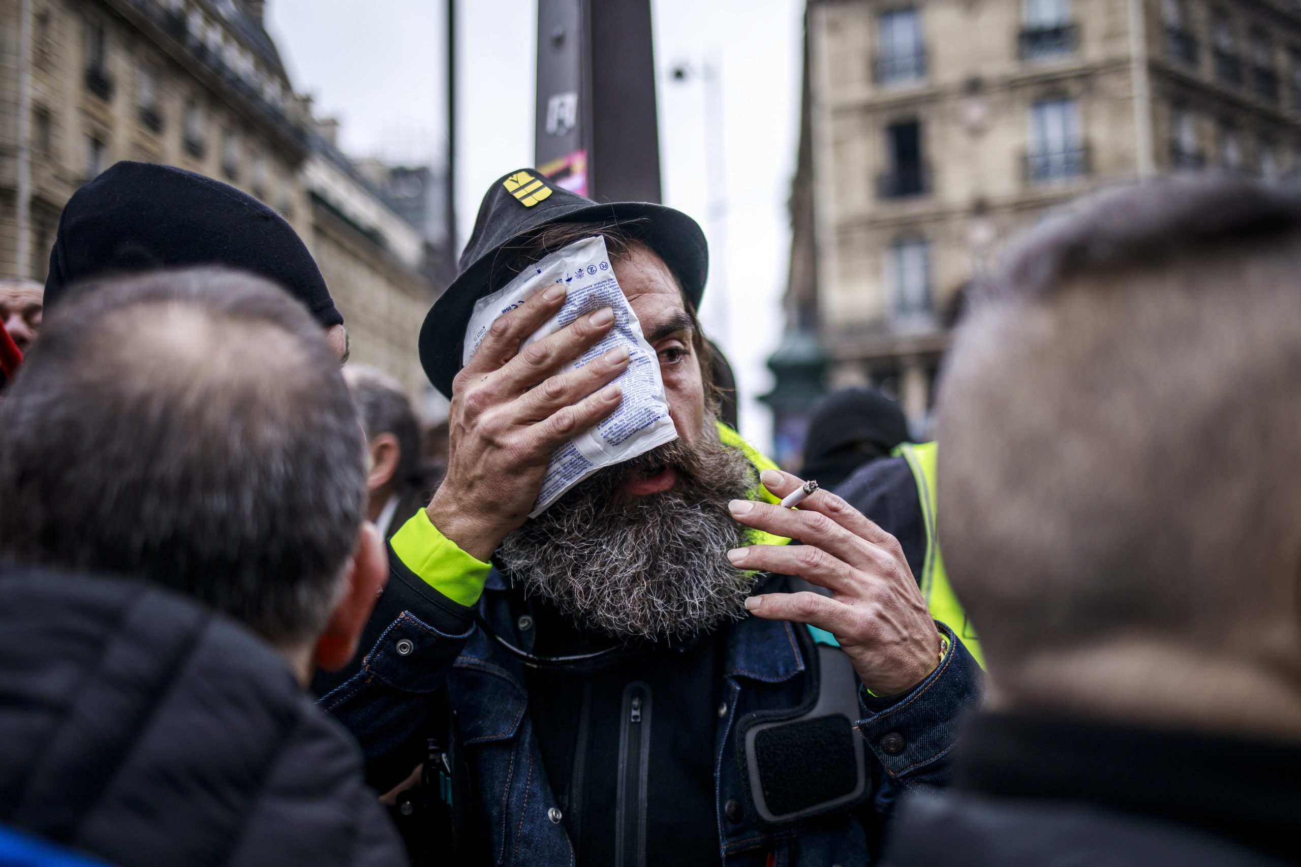 Polícias acusados em França por ferimentos contra ‘colete amarelo’ Jérôme Rodrigues