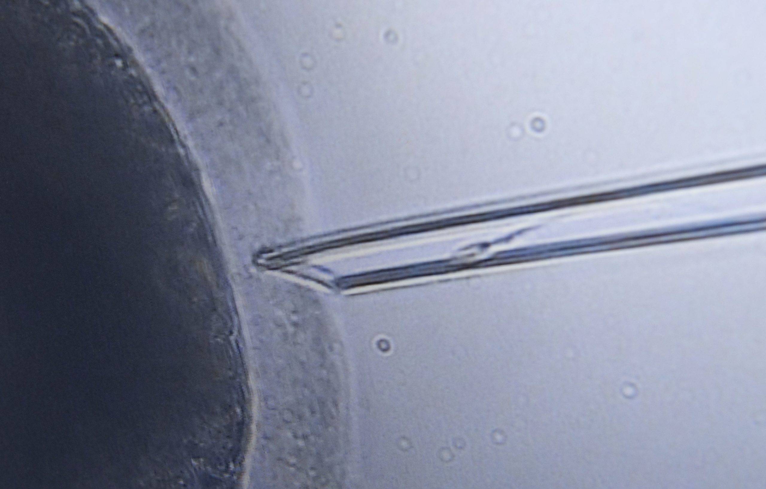 Ordem dos Biólogos alerta para riscos da inseminação caseira