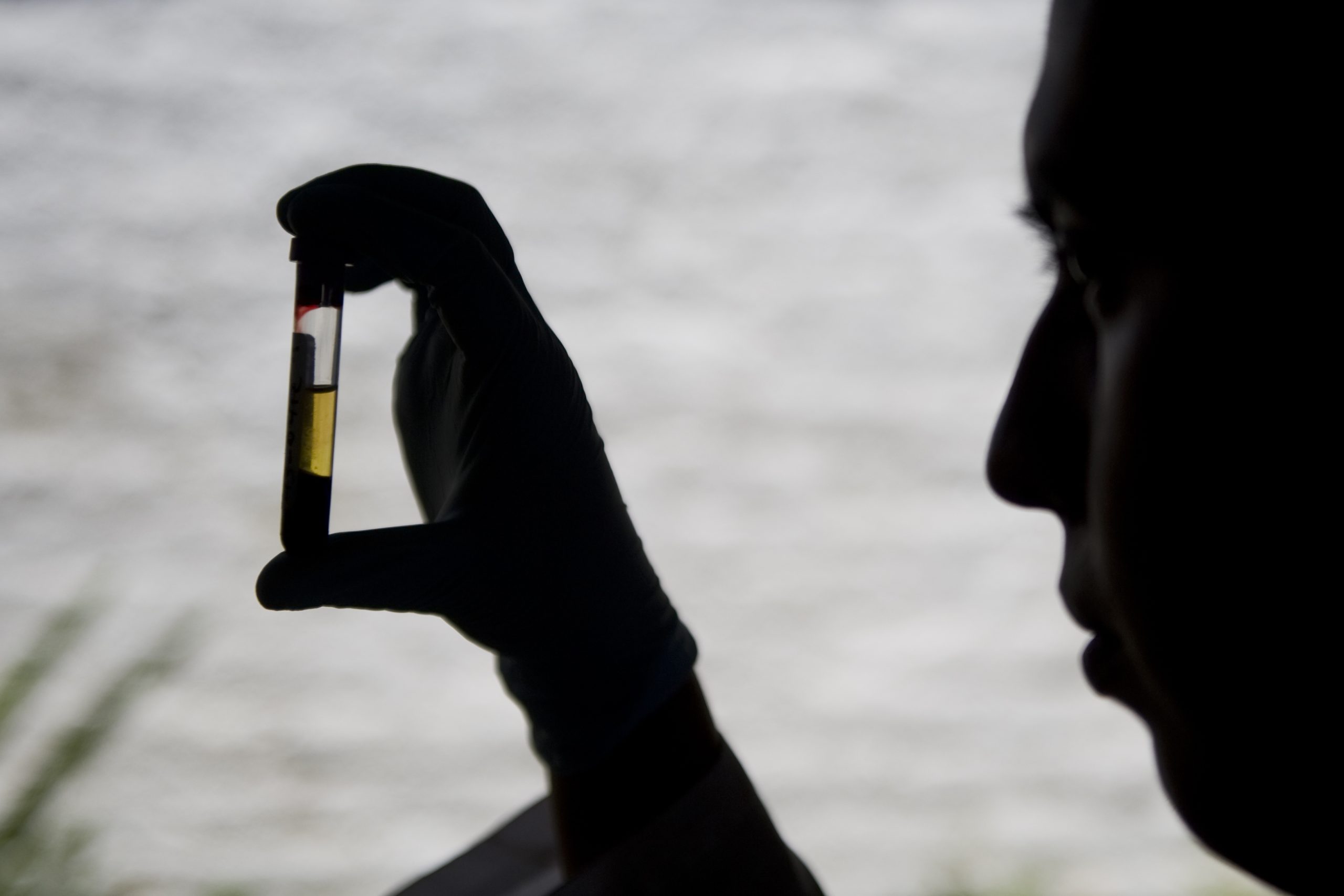 Covid-19: Associação promove rastreio ao cancro colorretal para diminuir atrasos no diagnóstico