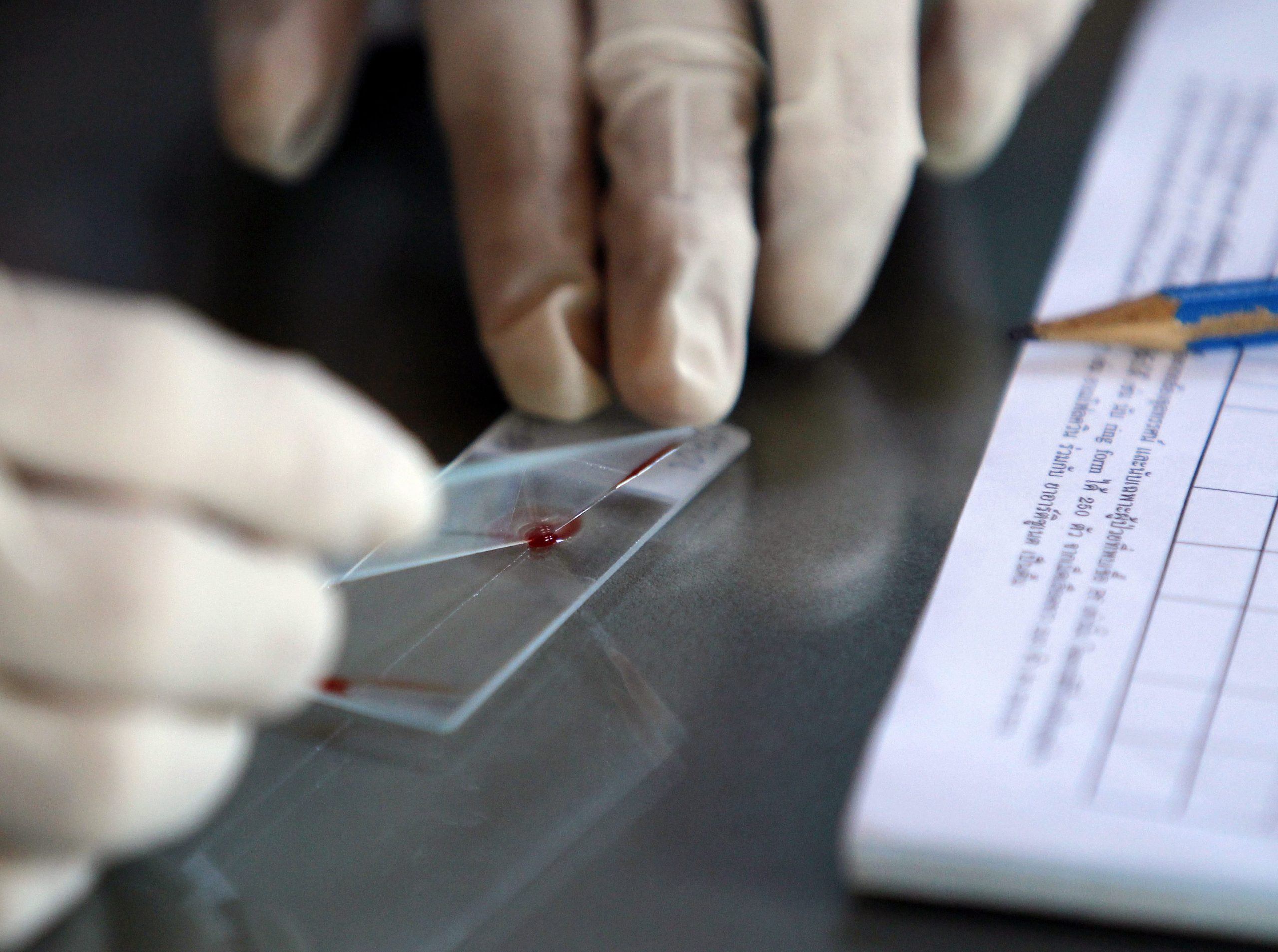 Teste rápido à malária vence primeiro prémio de programa da Universidade Nova
