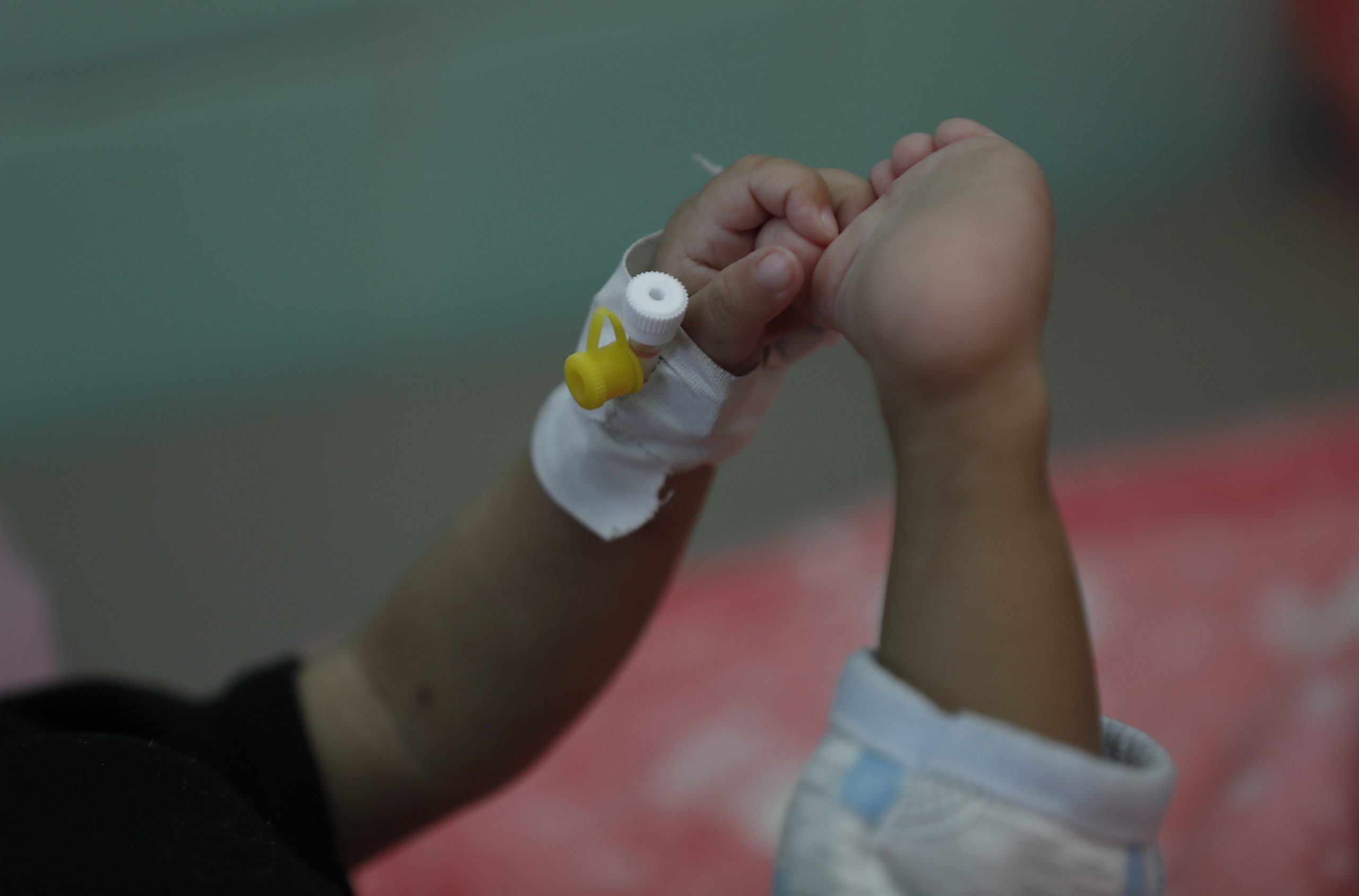 Casos de hepatite aguda registados em crianças de quatro países da União Europeia