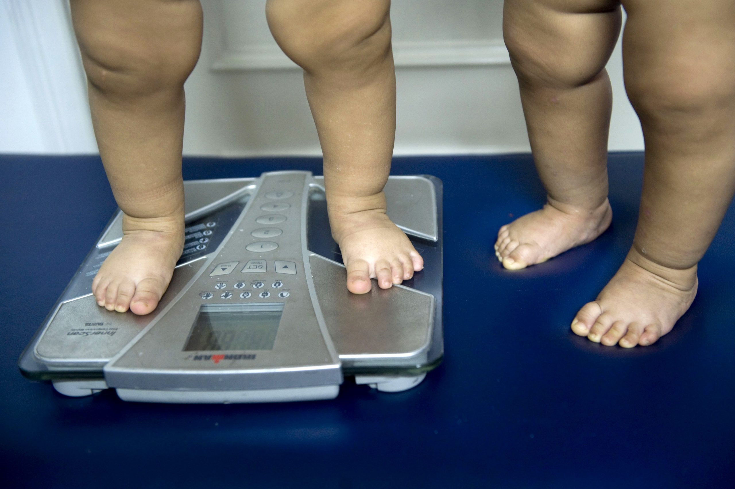 Mesmo que os indicadores não o digam, “a obesidade não é inofensiva”