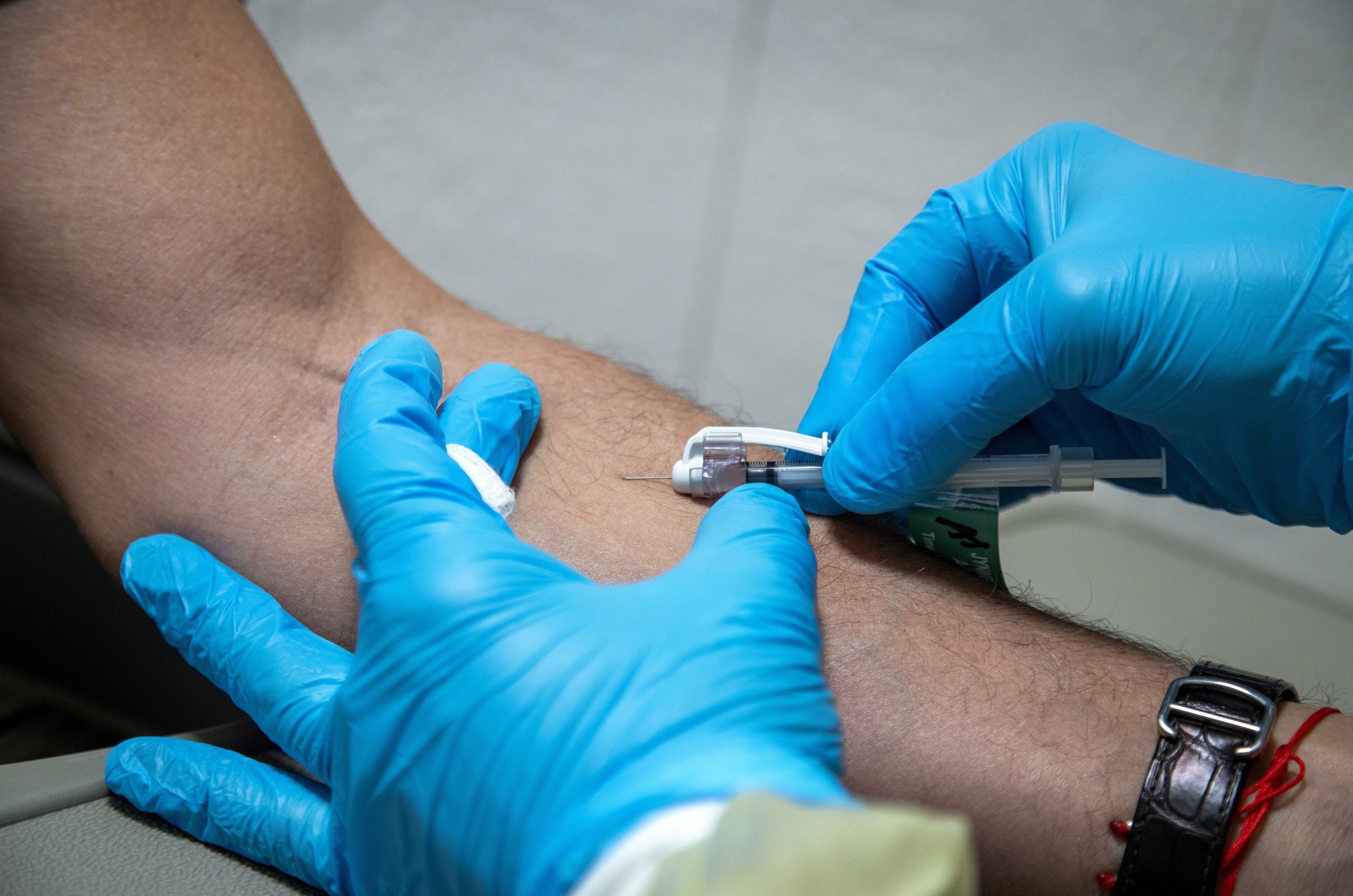 Varíola-dos-macacos: Espanha adota vacinação que permite quintuplicar doses