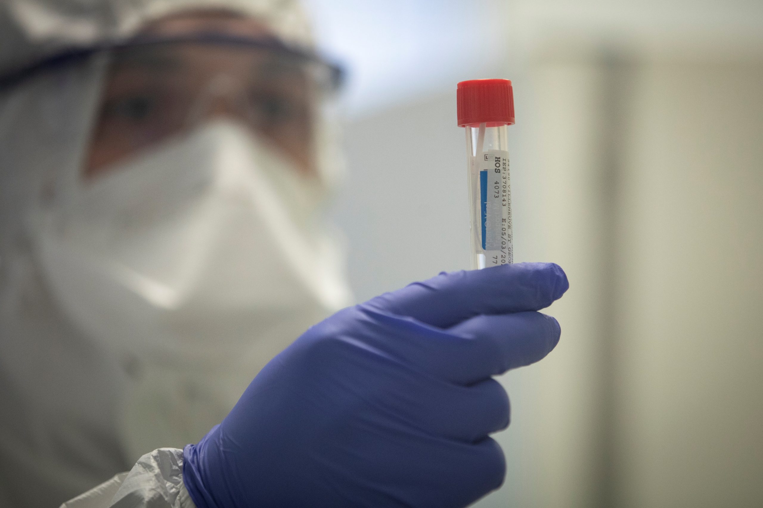 Covid-19: China anuncia primeiro ensaio clínico de vacina