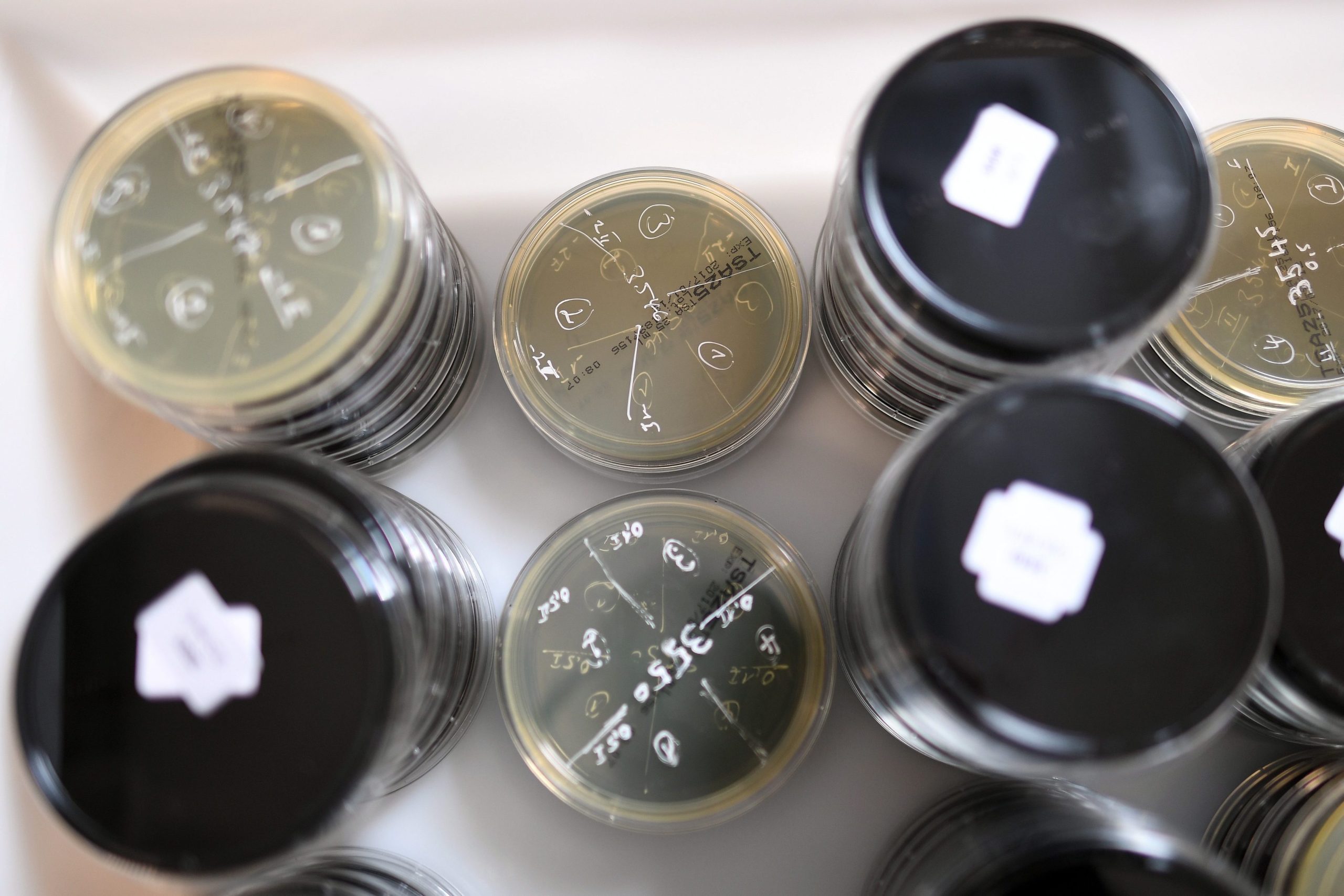 Número de internados devido a surto de ‘legionella’ no Grande Porto diminui