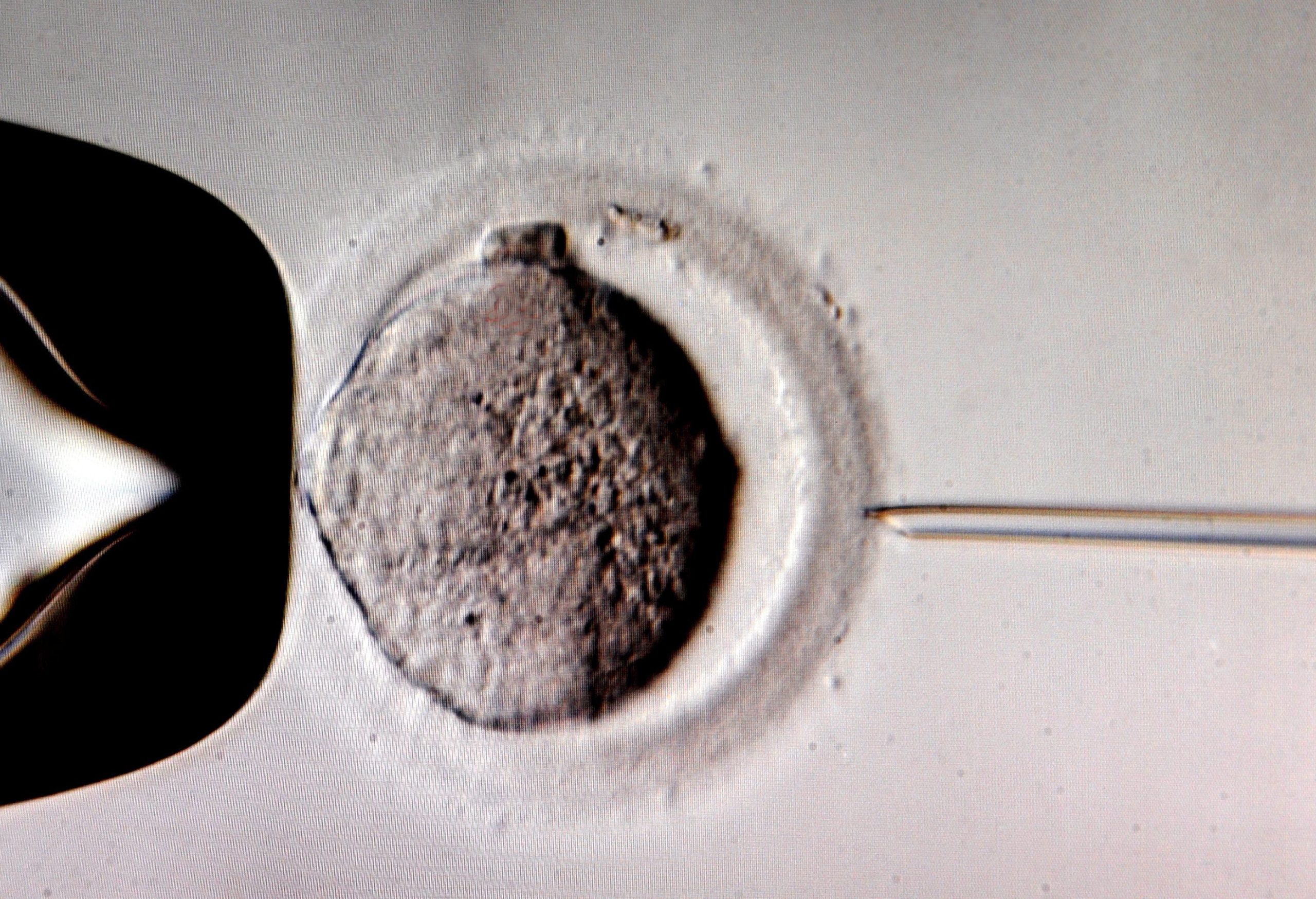26 mulheres podem ter sido inseminadas com esperma errado