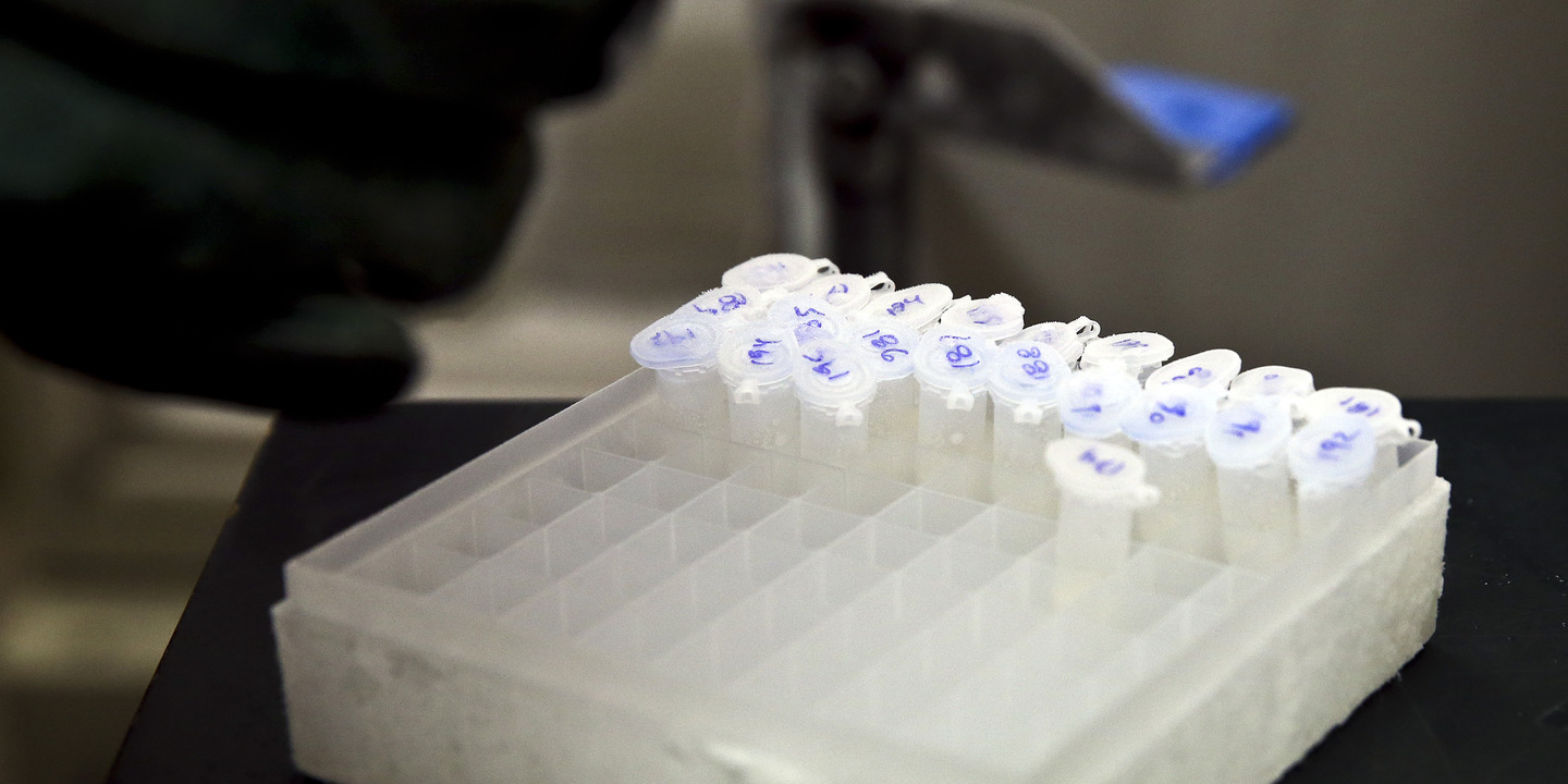 Universidade de Coimbra autorizada a distribuir isótopo essencial para diagnóstico do cancro