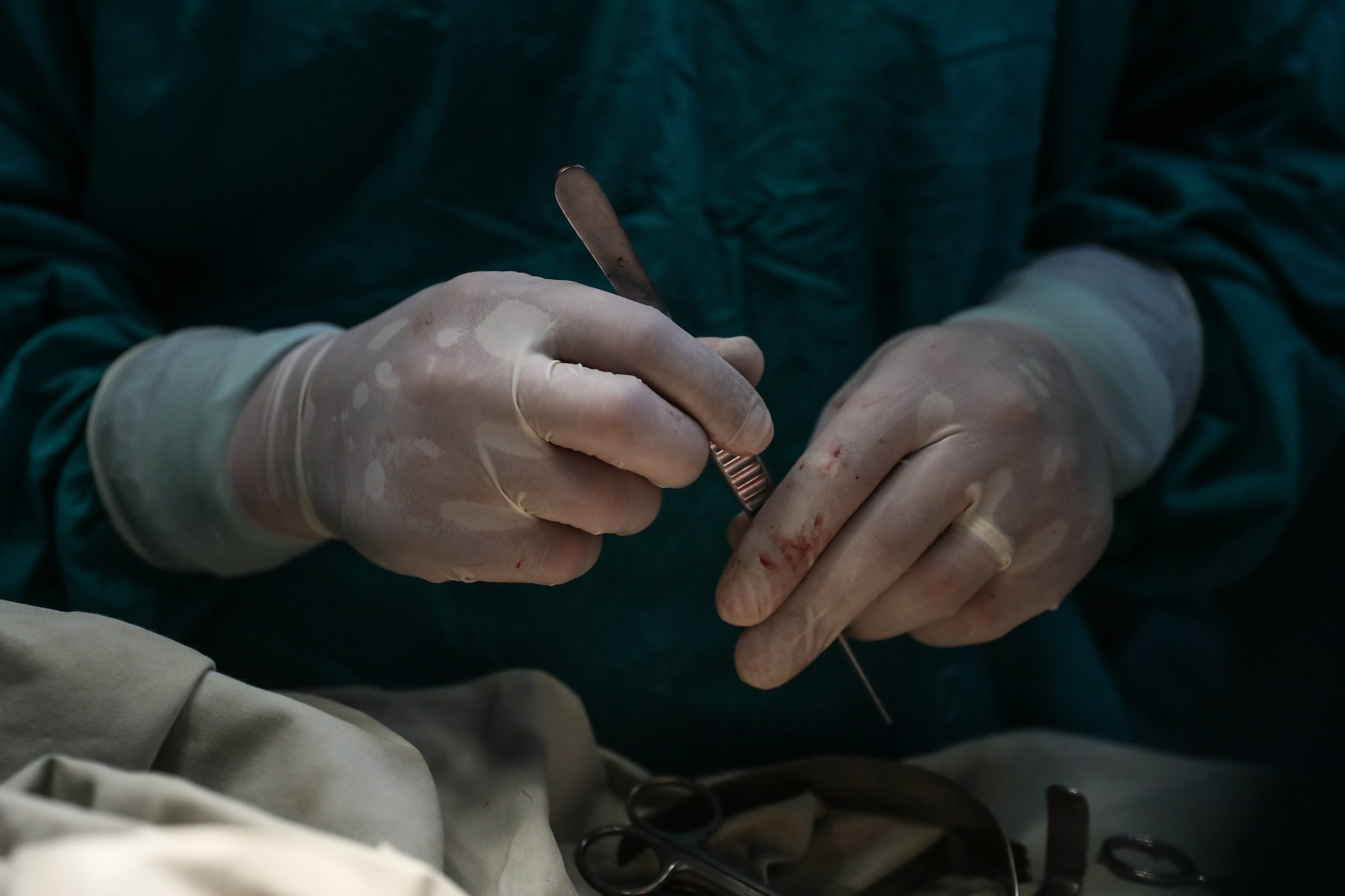 Cirurgia cardiotorácica de Coimbra operou 17 doentes em Moçambique, maioria crianças