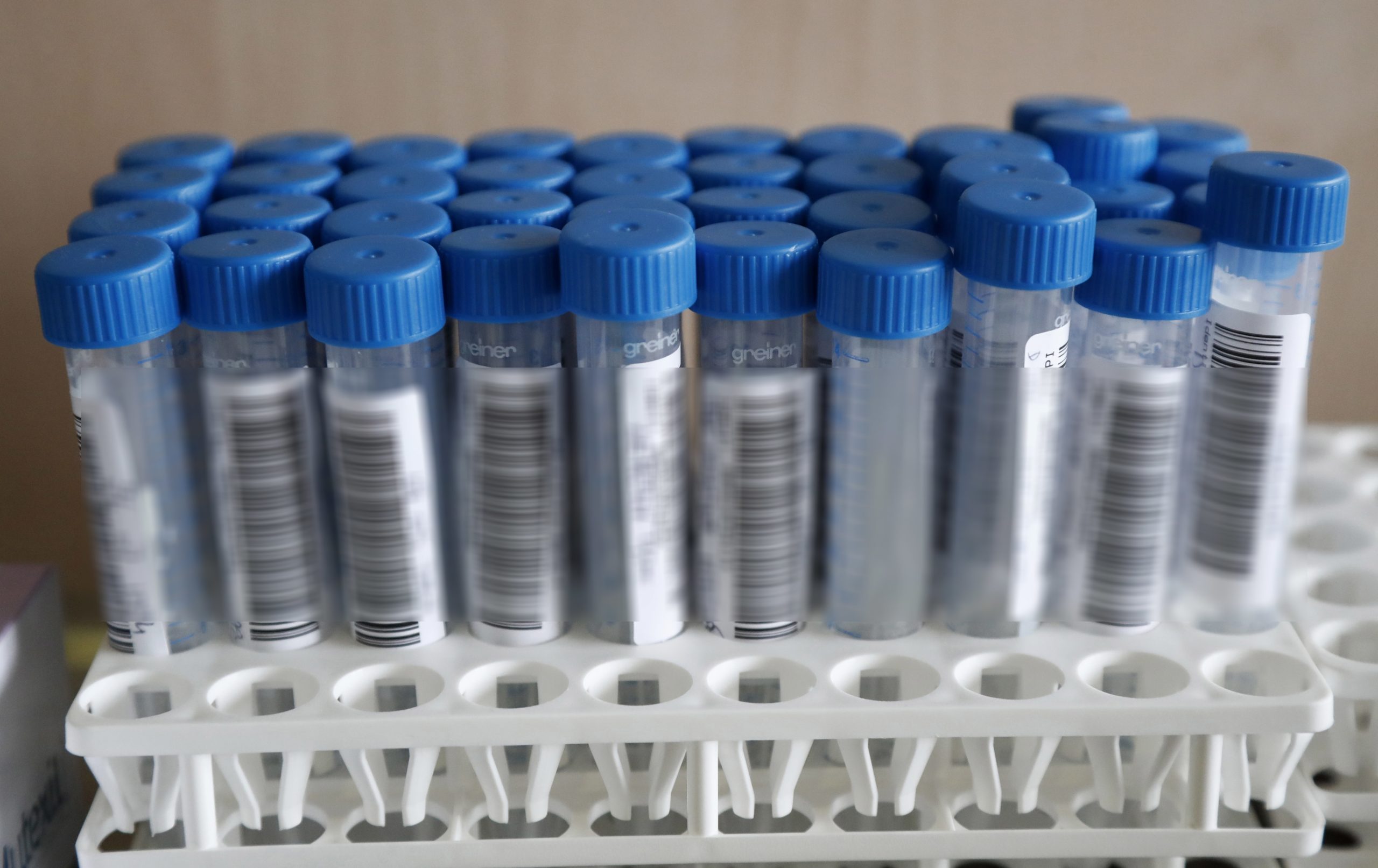 Covid-19: Vinte mortes e contaminação de 100% em dois lares de Mirandela