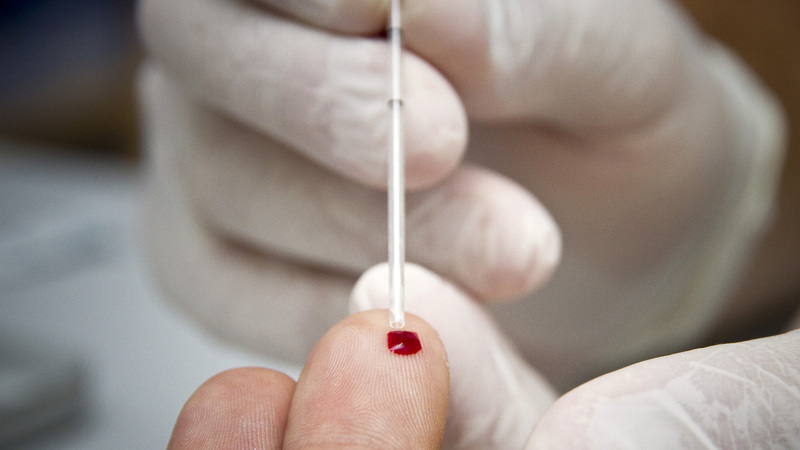 Semana de rastreio às infeções pelo VIH e hepatites começa na segunda-feira
