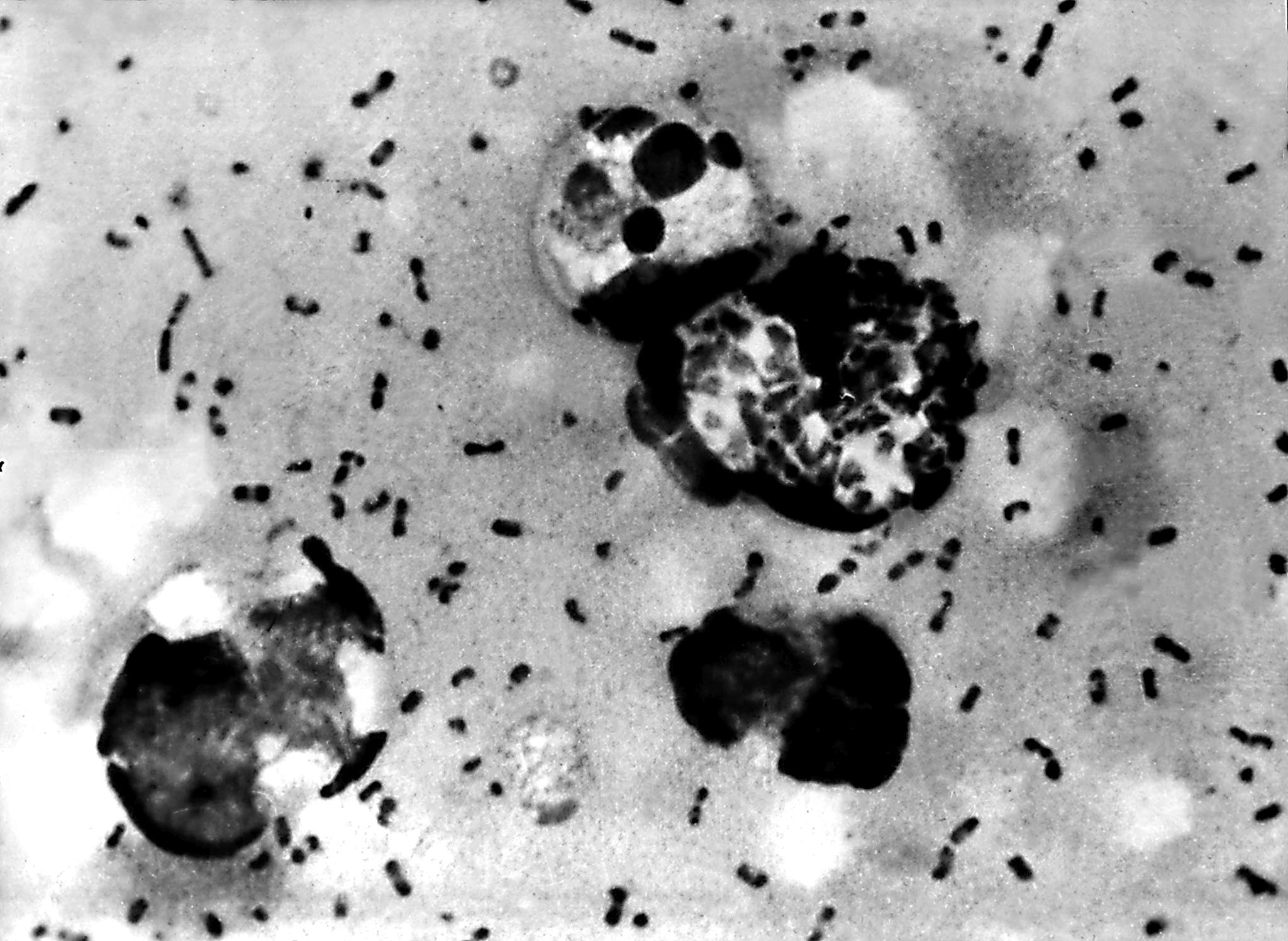 Erupção vulcânica pode ter desencadeado propagação rápida da Peste Negra, revela estudo