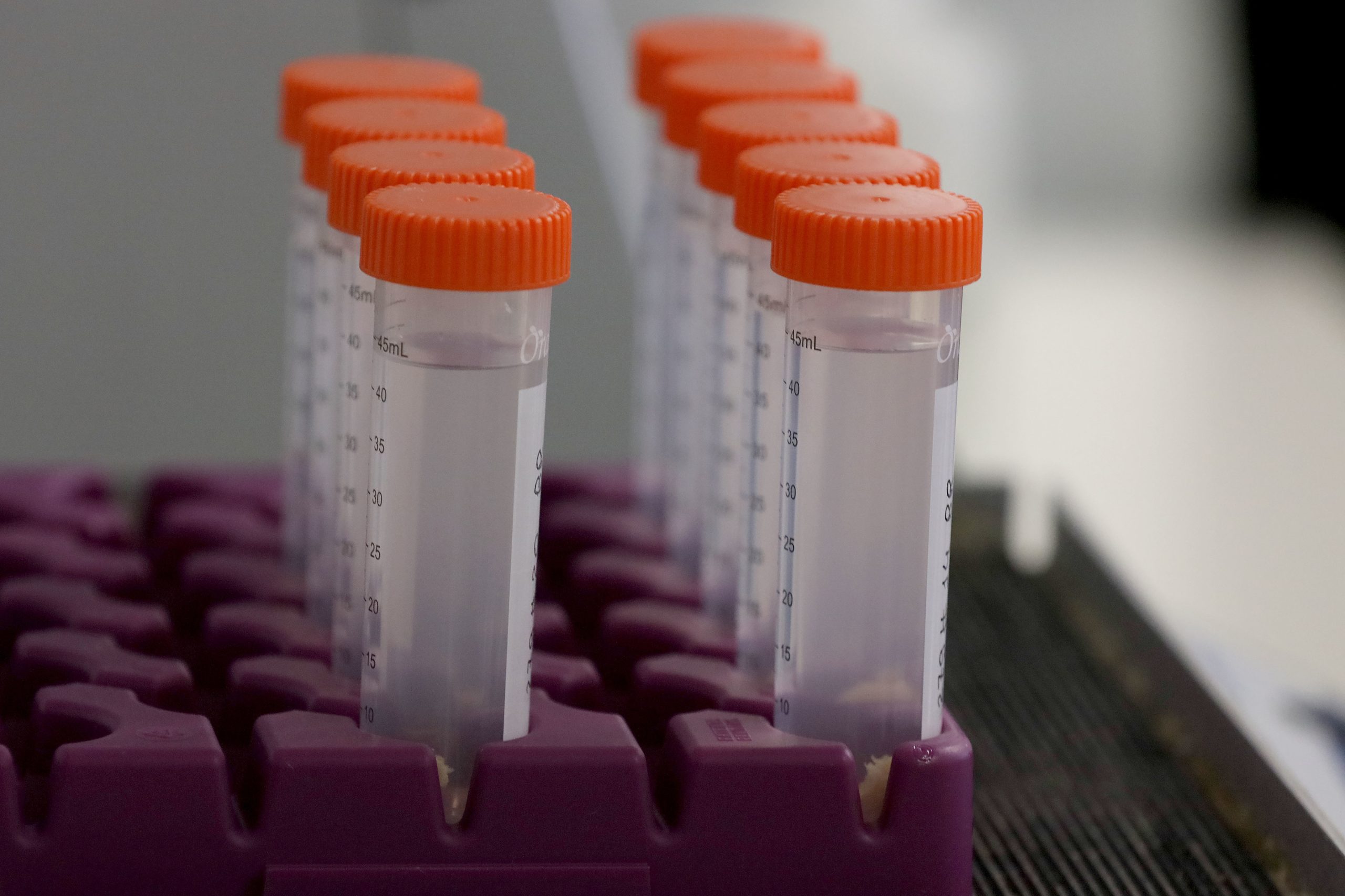 Mudanças intensivas no estilo de vida podem travar (ou até reverter) Alzheimer em fase inicial