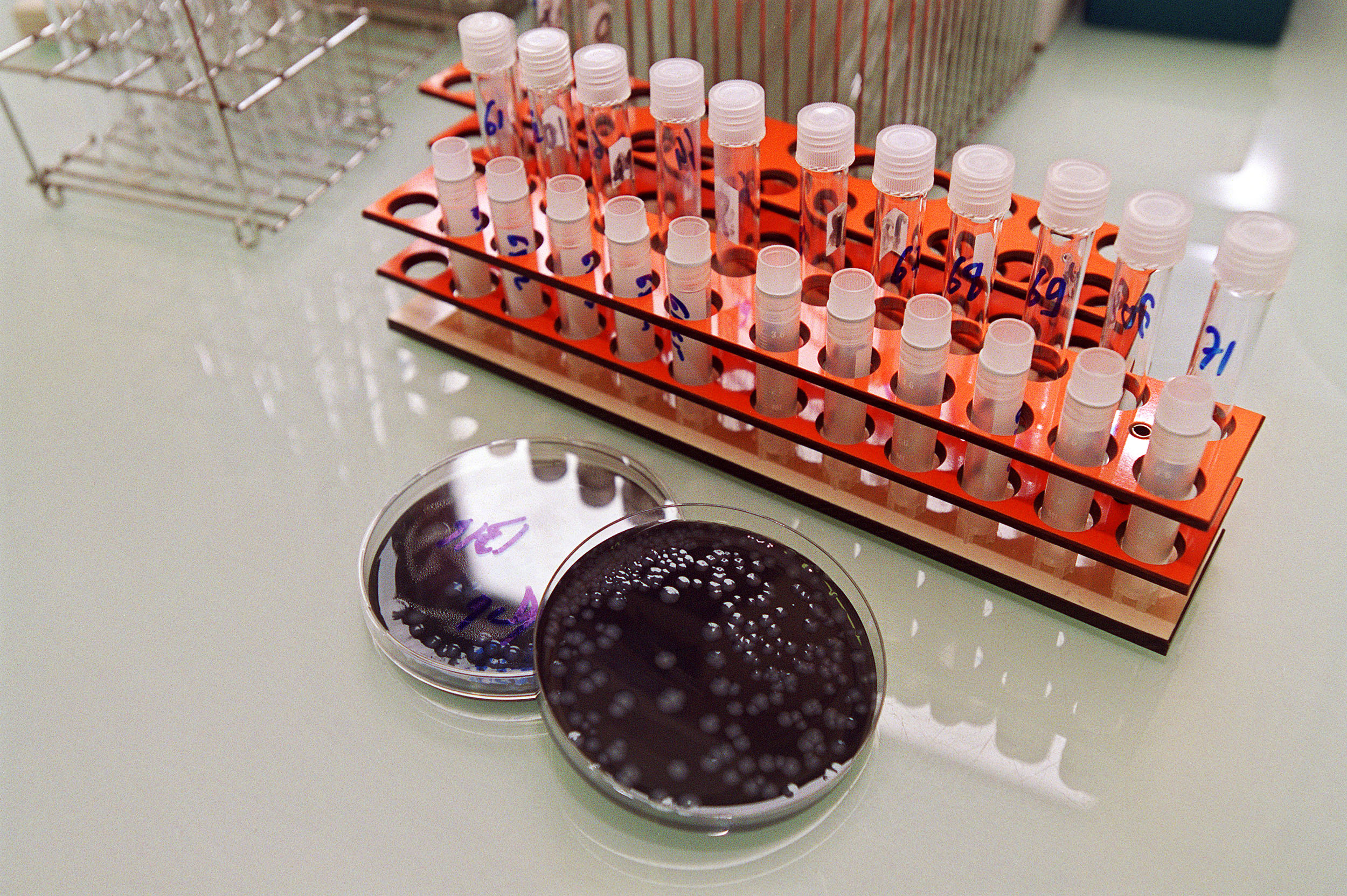 Legionella: Origem do foco de infeção ainda não está esclarecida