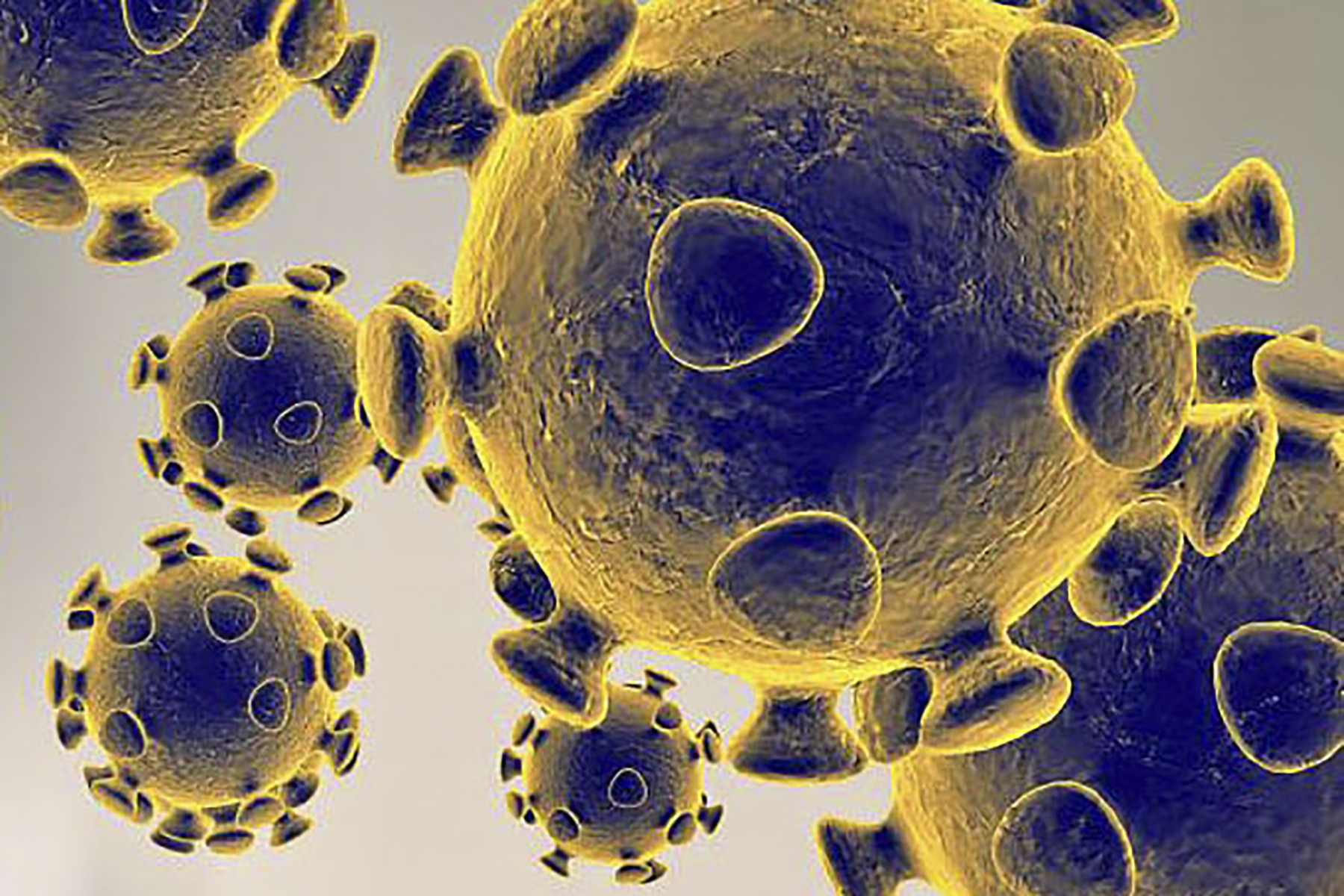 Casos de gripe e infeções respiratórias pressionam urgências, SNS 24 e INEM