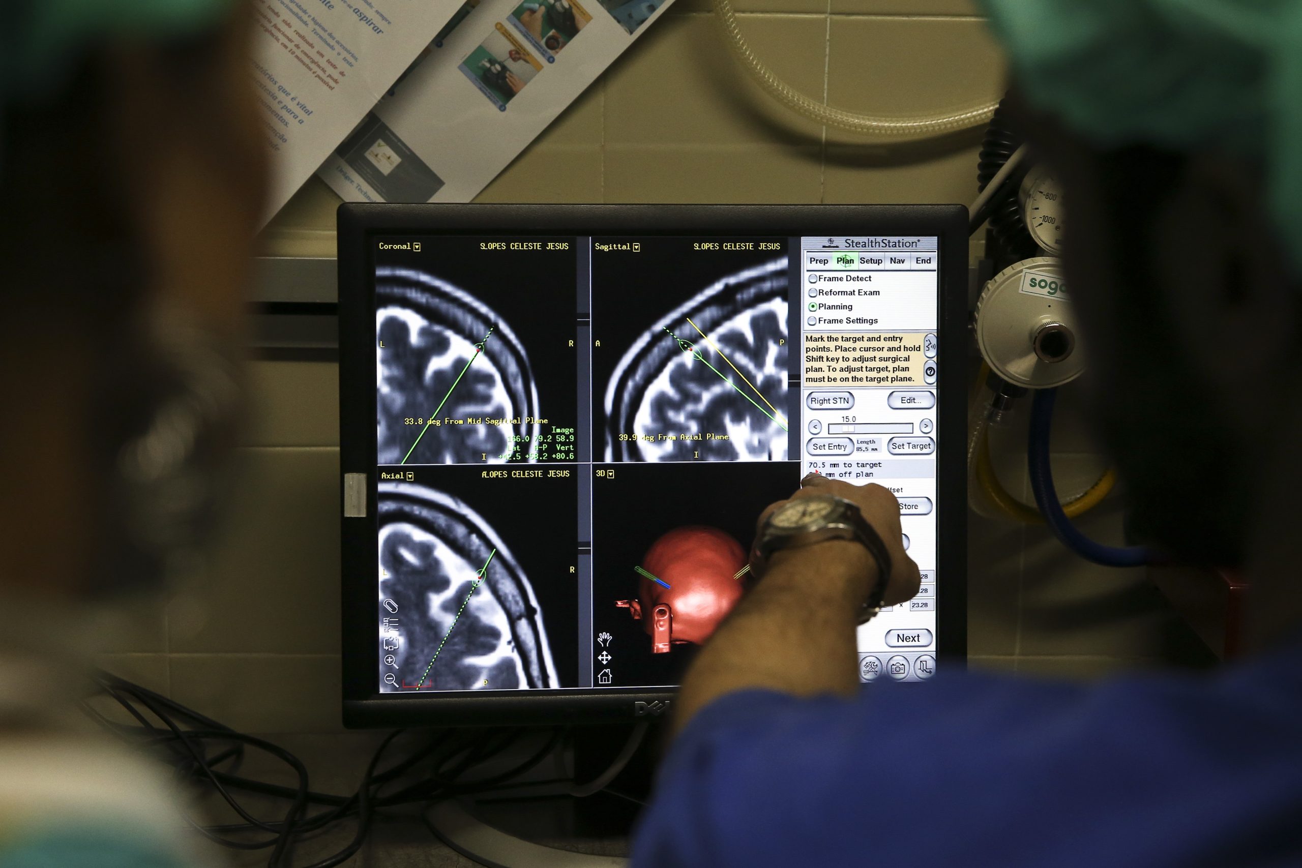 Prémios Santa Casa Neurociências distinguem investigações sobre doença de Parkinson e medula espinhal