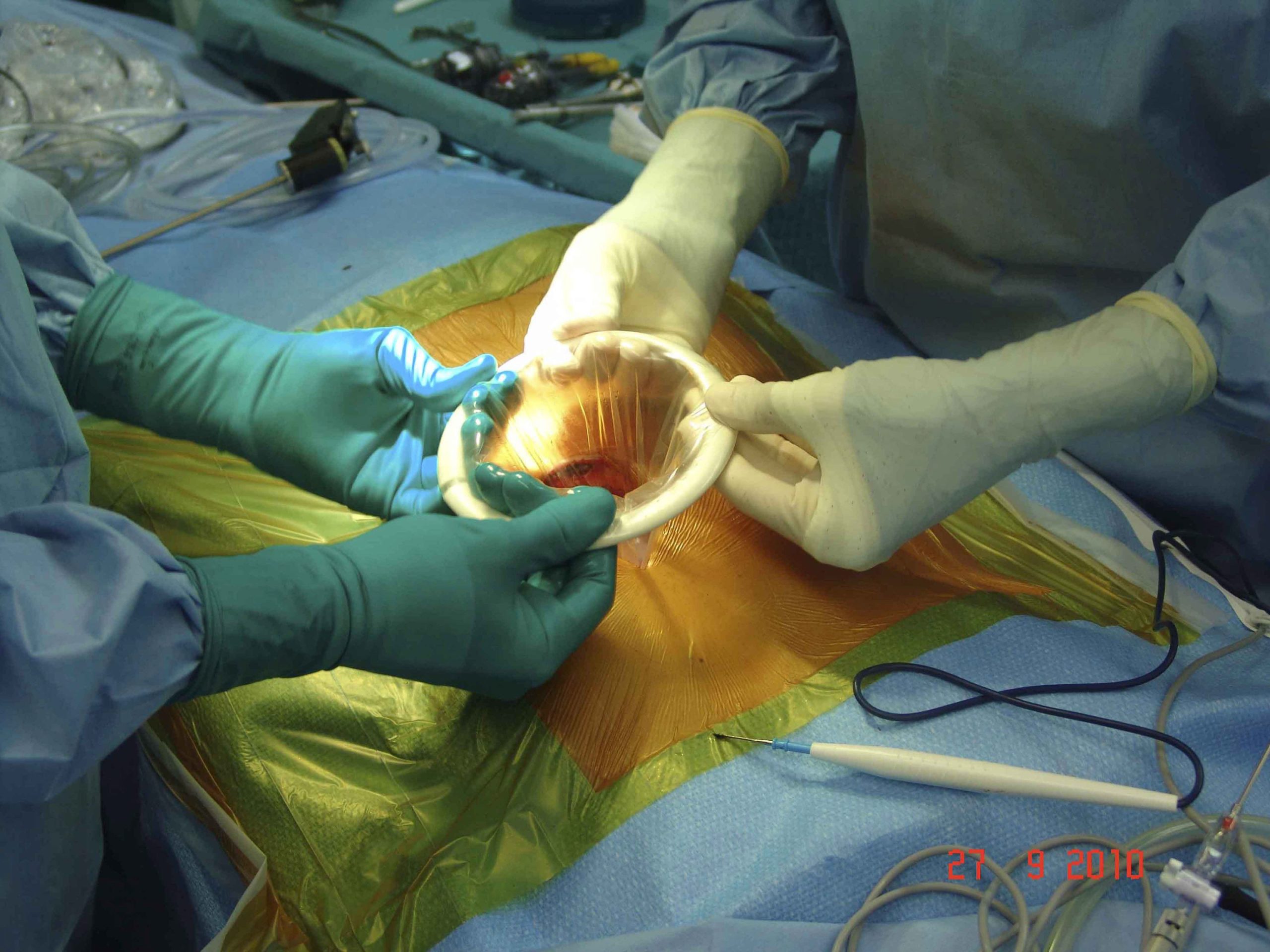 Nova droga aumenta tempo de vida de doentes com cancro pancreático