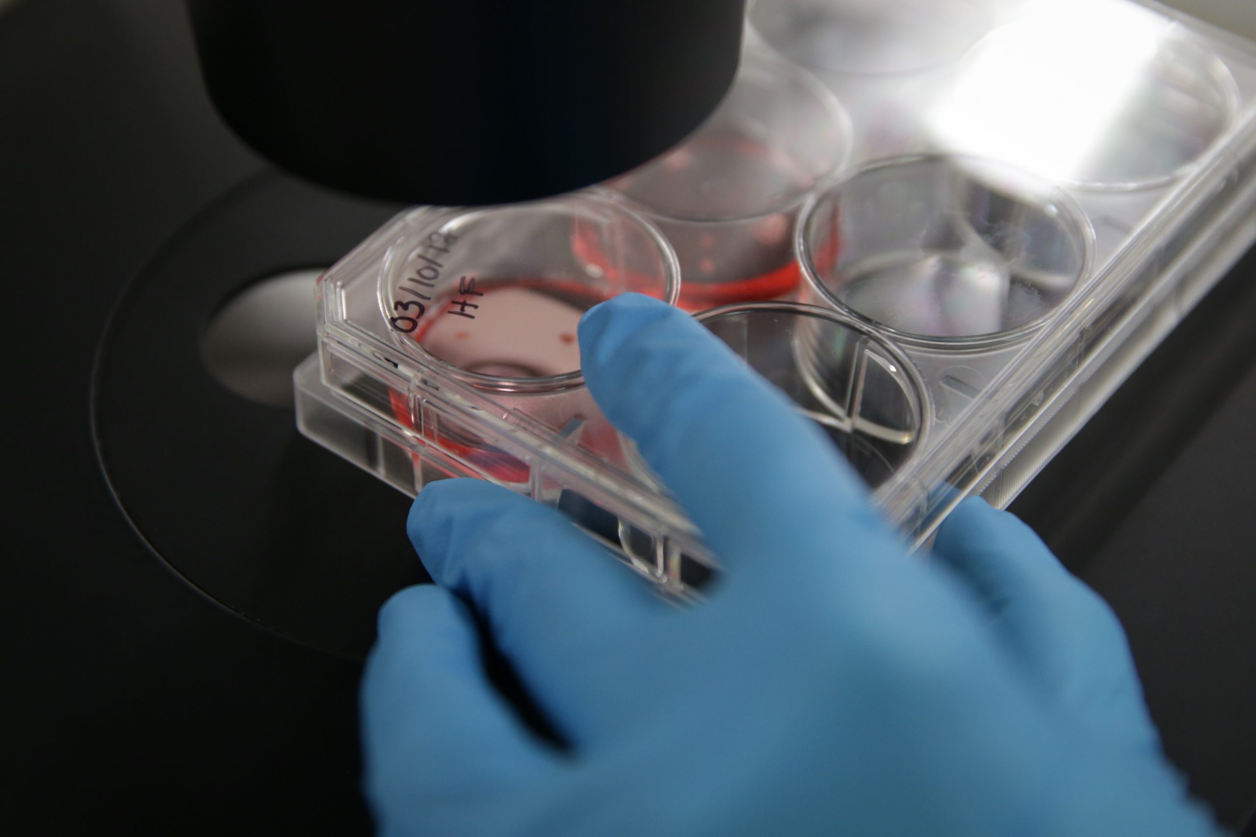 Investigadores portugueses desenvolvem teste genético que ajuda a tratar doentes com uma gota de saliva