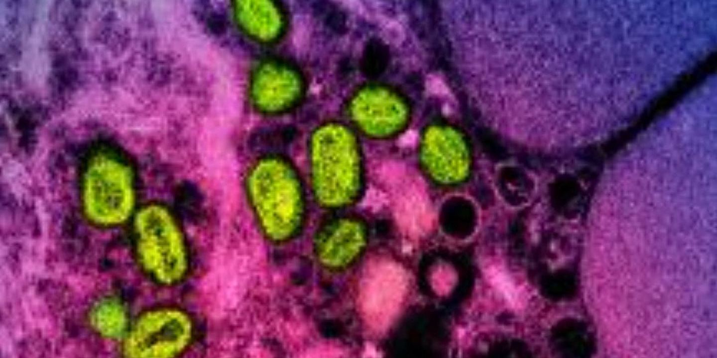 Há uma nova variante da Mpox transmitida principalmente entre humanos