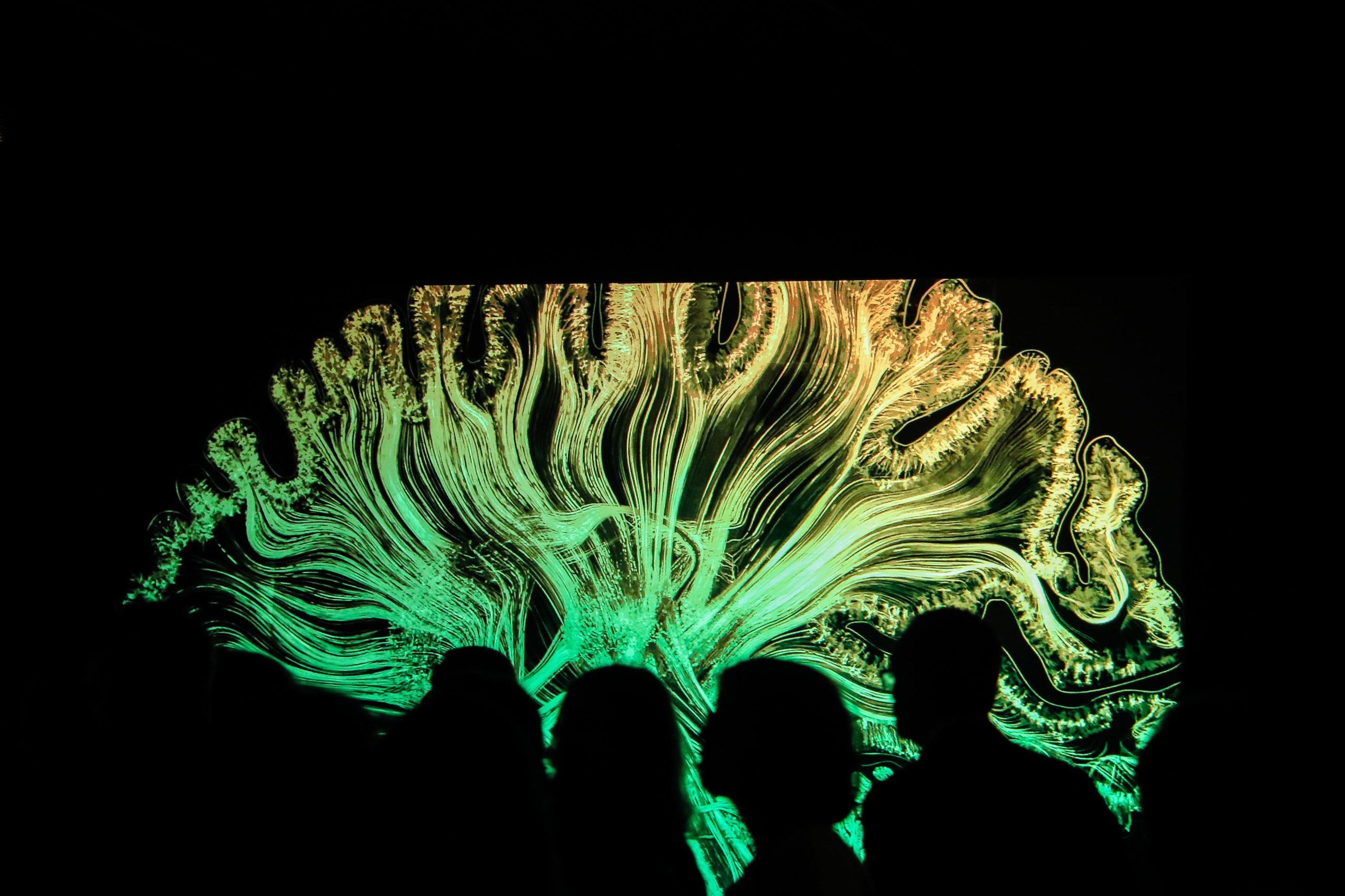 Estudo conclui que autistas têm cérebro menos assimétrico do que o habitual