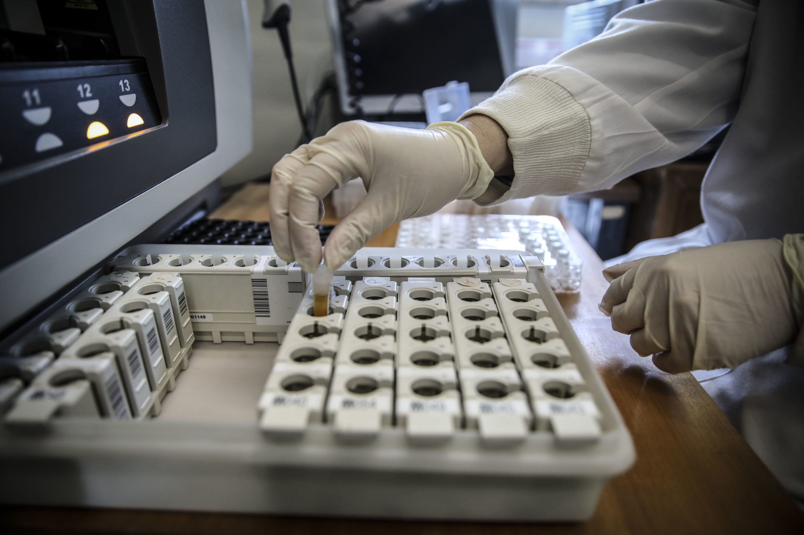 Covid-19: Investidos quase 8,5 milhões de euros nos laboratórios do Serviço Nacional de Saúde