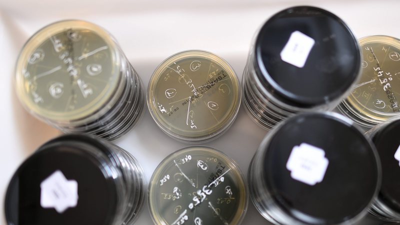 Legionella: Empresas chegam a acordo com 32 vítimas do surto de Vila Franca de Xira
