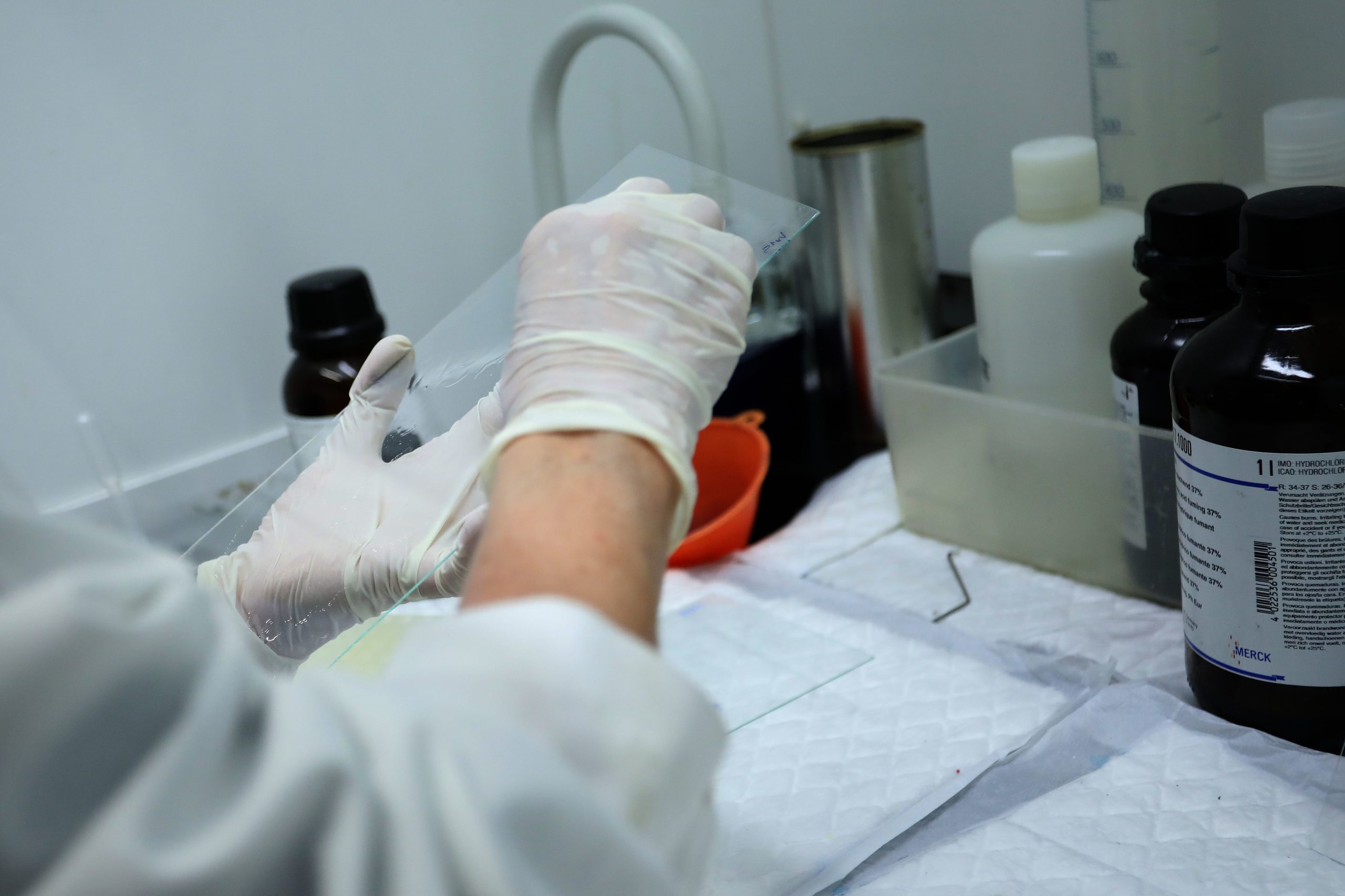 Investigadores comprovam eficácia de botox para tratamento de dor pélvica crónica
