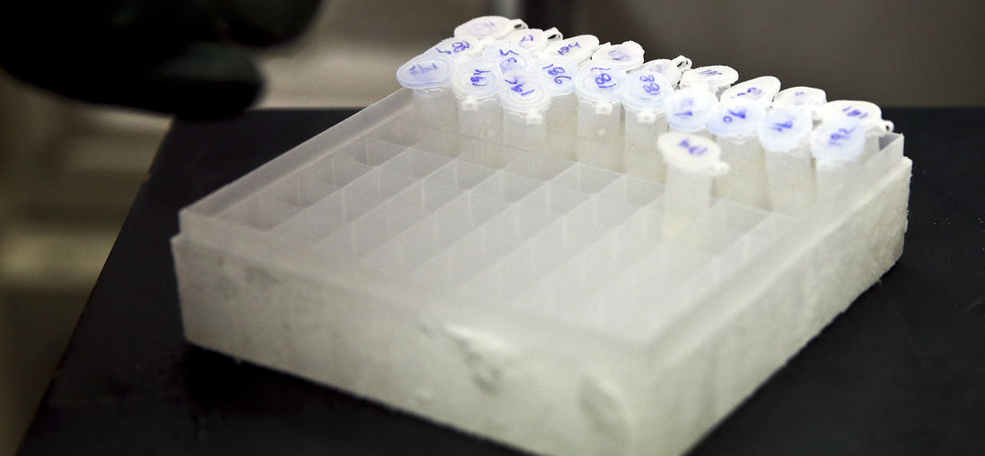 Dois novos casos de ‘legionella’ diagnosticados no Grande Porto