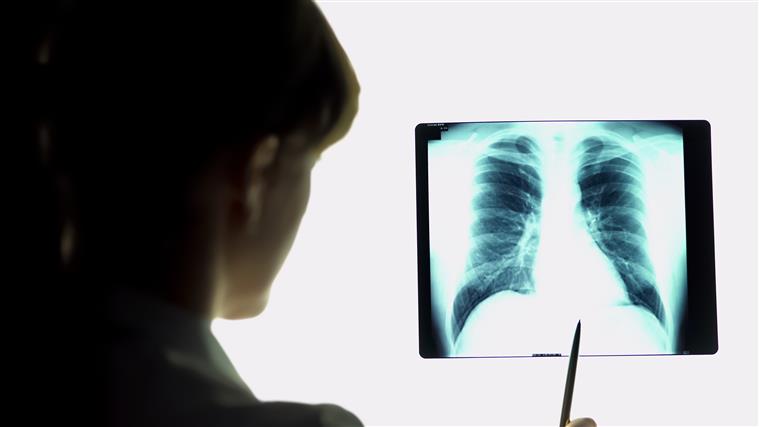 Investigadora apela a maior visibilidade para doenças respiratórias em Portugal