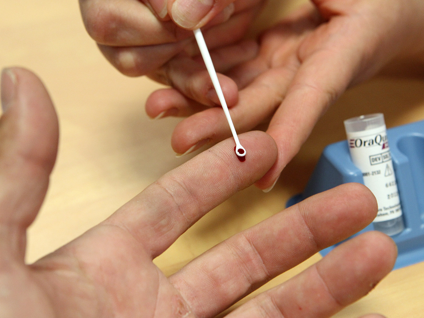 Confirmados 280 casos de hepatite A em Portugal desde o início do ano