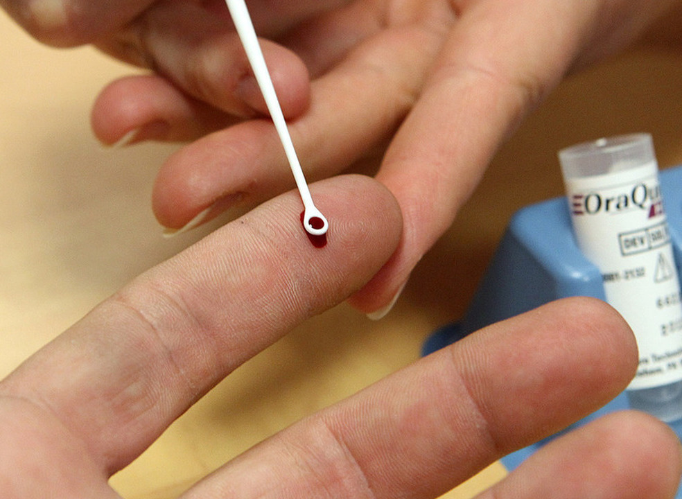 Autoridades atentas e preparadas para intervir perante casos de hepatite aguda atípica