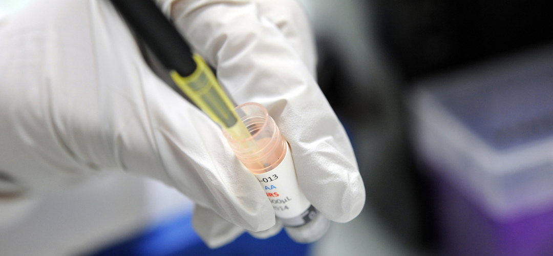 Precisamos mesmo de detox caseiros contra parasitas?