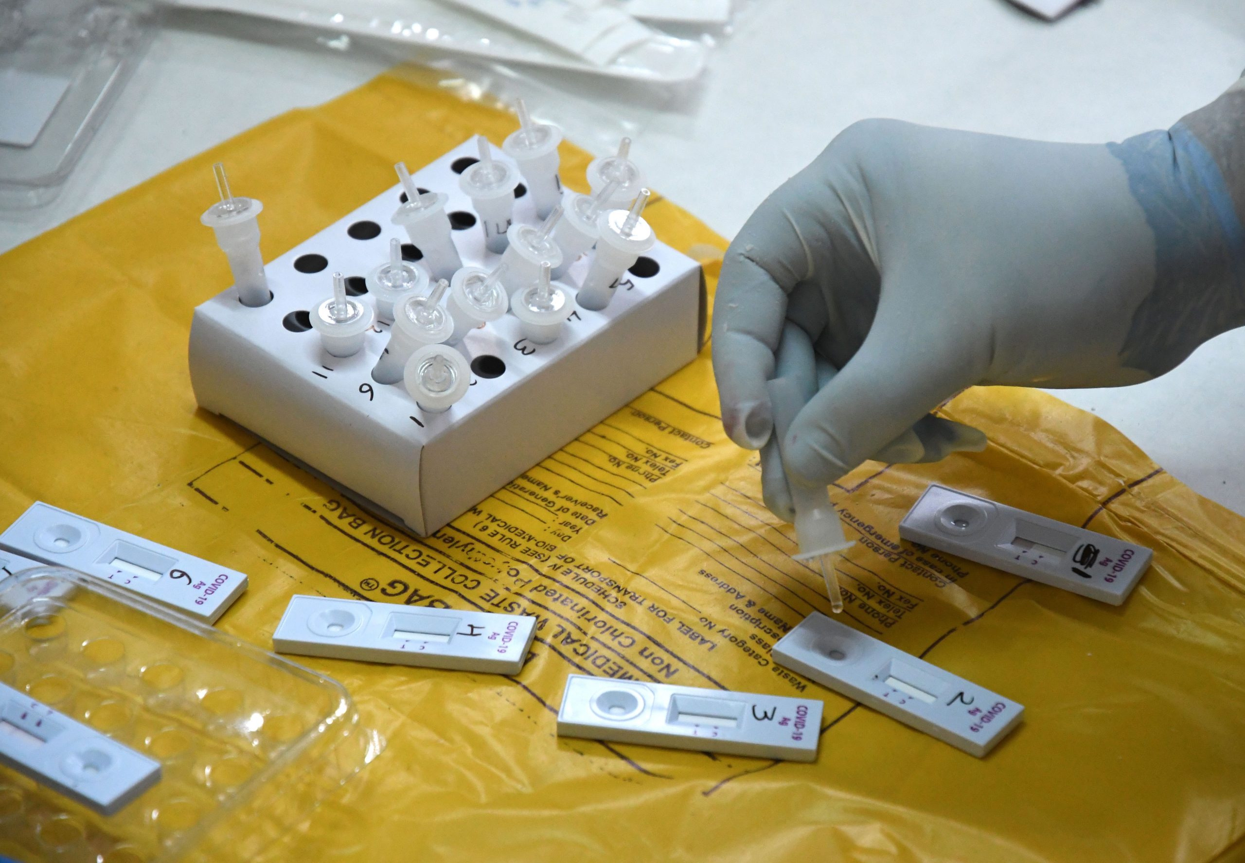 Pandemia custou ao Estado 3.302 milhões de euros