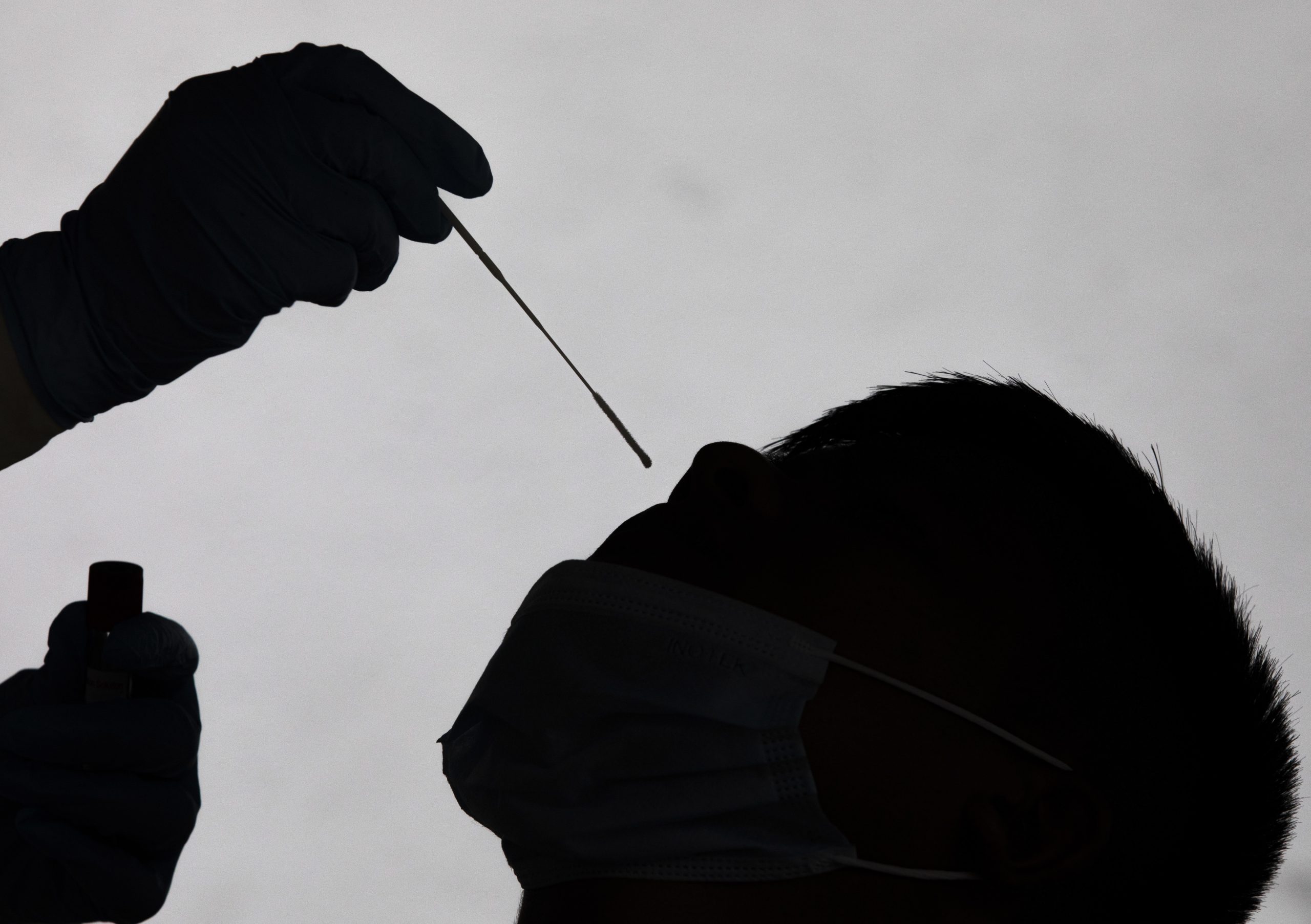 Investigadores descobrem marcador biológico que antecipa a gravidade da covid-19
