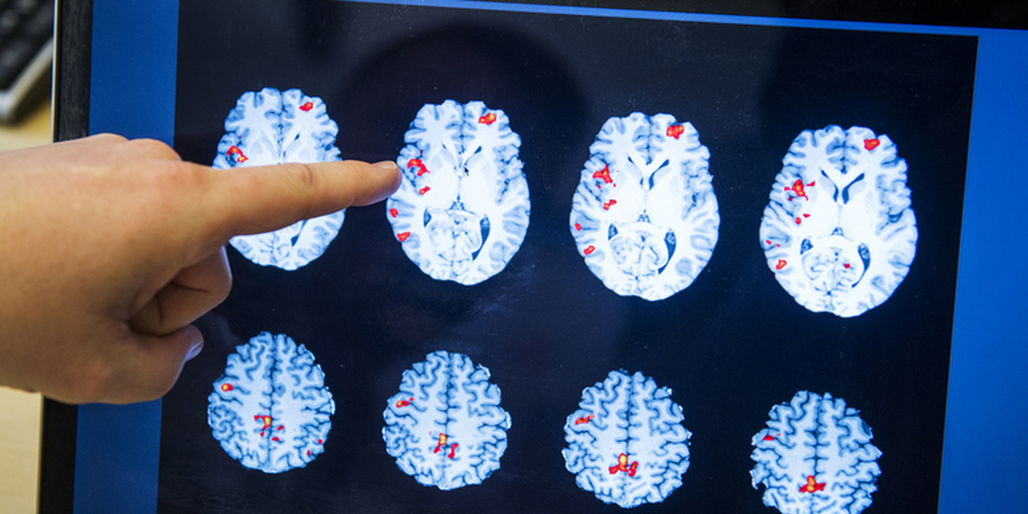 O ‘regresso’ dos eletrochoques. Hospital de São João utiliza estimulação magnética em casos de depressão e perturbação obsessiva-compulsiva
