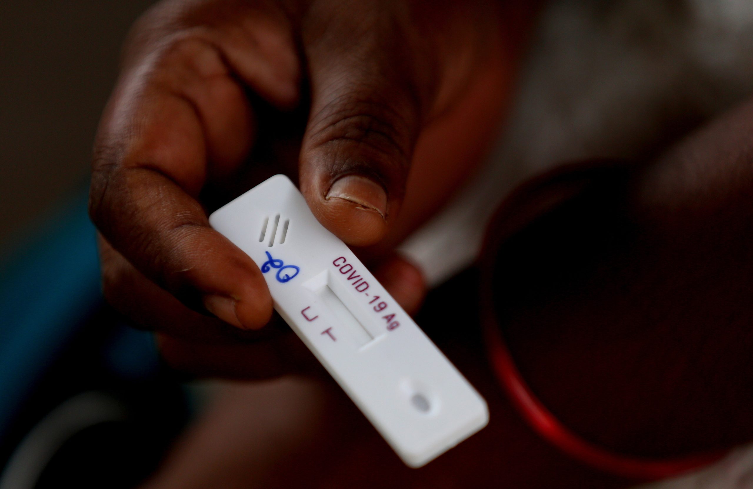 Covid-19: África com 215 mortos em 24 horas e 8.302 novos casos
