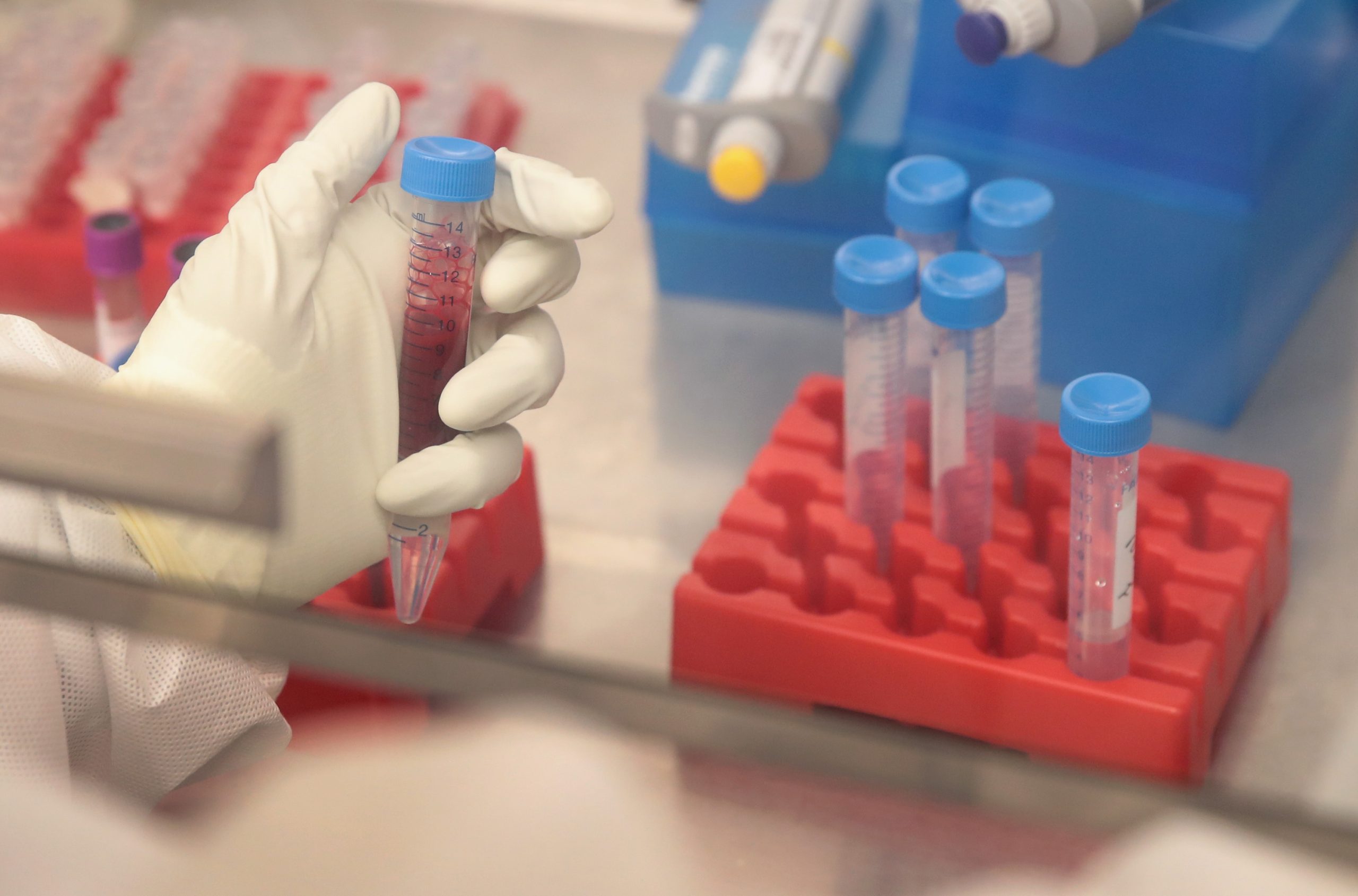 Cientista portuguesa decobriu mecanismo de resistência das células ao vírus da Sida