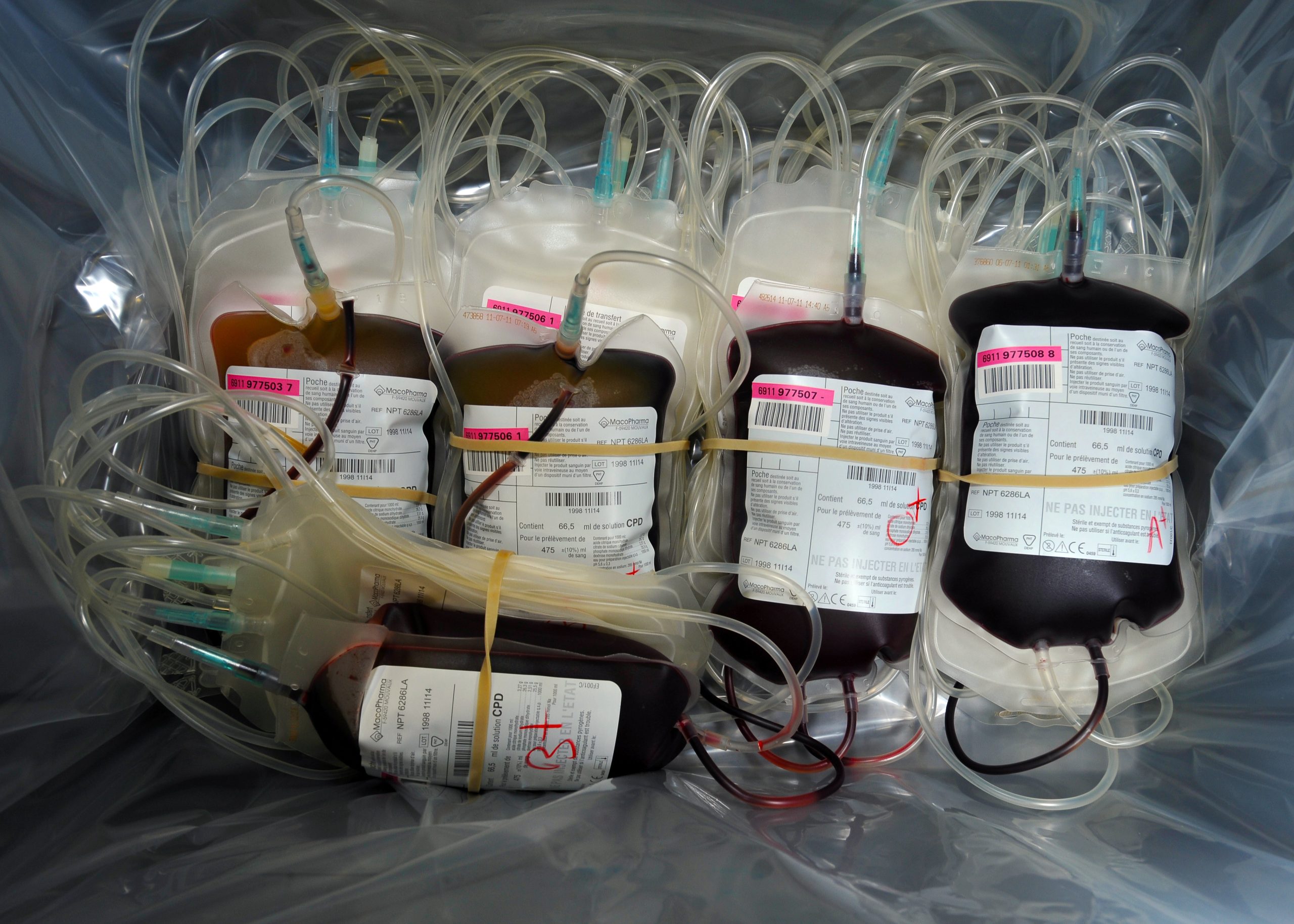 Por 8 mil dólares esta startup oferece, literalmente, sangue novo