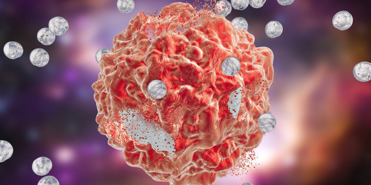 Médicos testam nova técnica mais precisa de ressonância magnética em doentes com cancro do reto