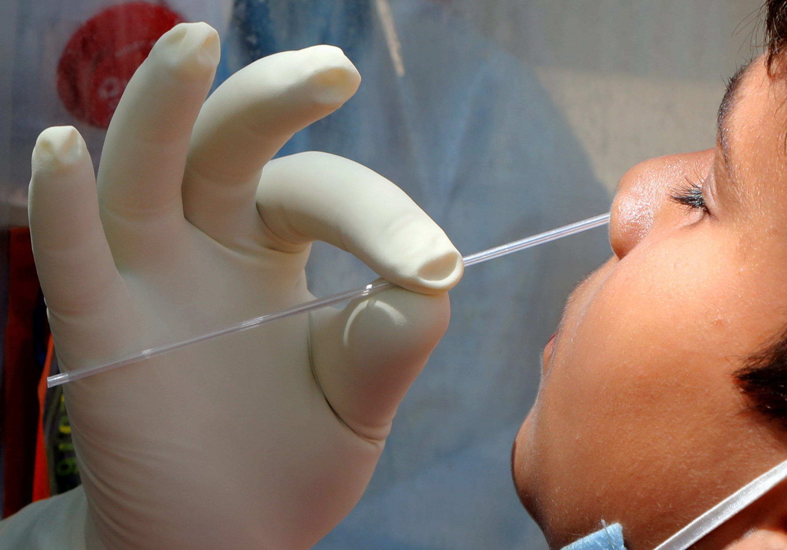 Países Baixos confirmam 19 casos de crianças com síndrome inflamatória associada à doença