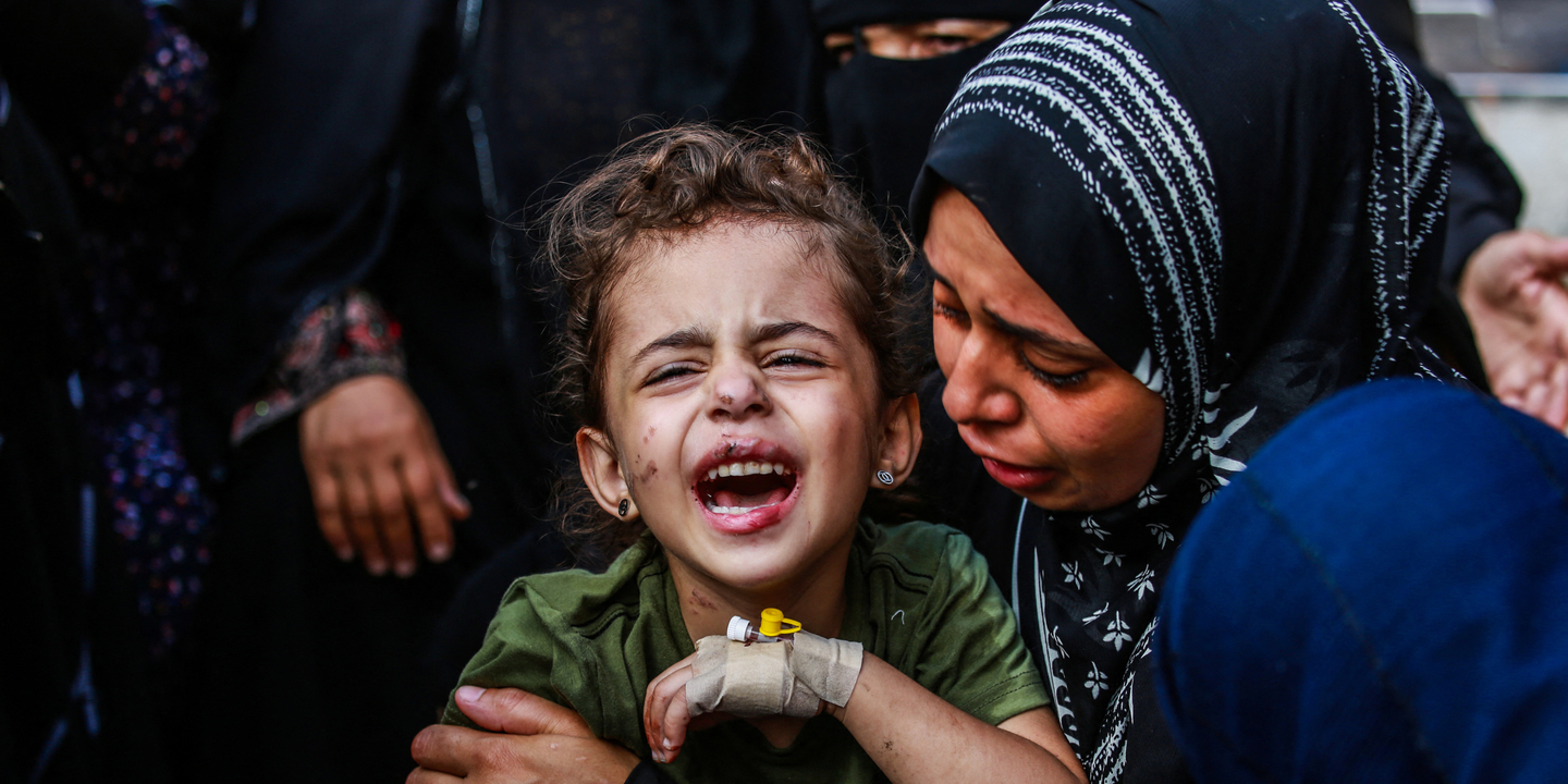 Sarna e piolhos propagam-se nas crianças em Gaza. Imagens perturbadoras