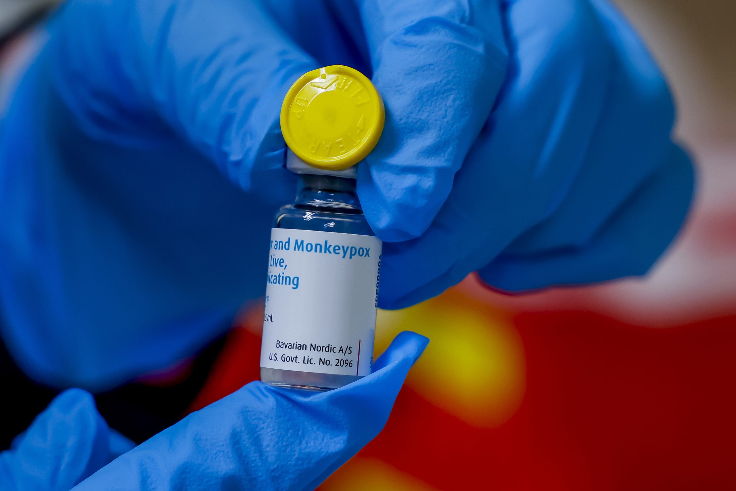 Monkeypox: Número de casos confirmados em Portugal sobe para os 926