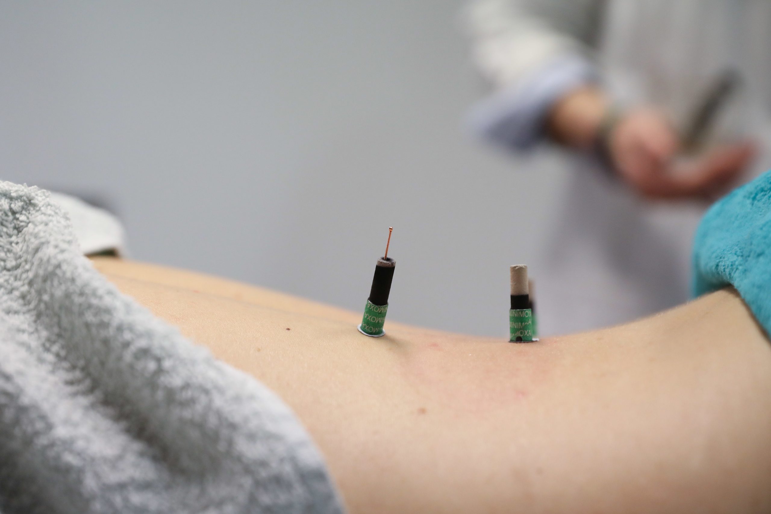 Medicina chinesa tem mestrado no Porto há uma dezena de anos