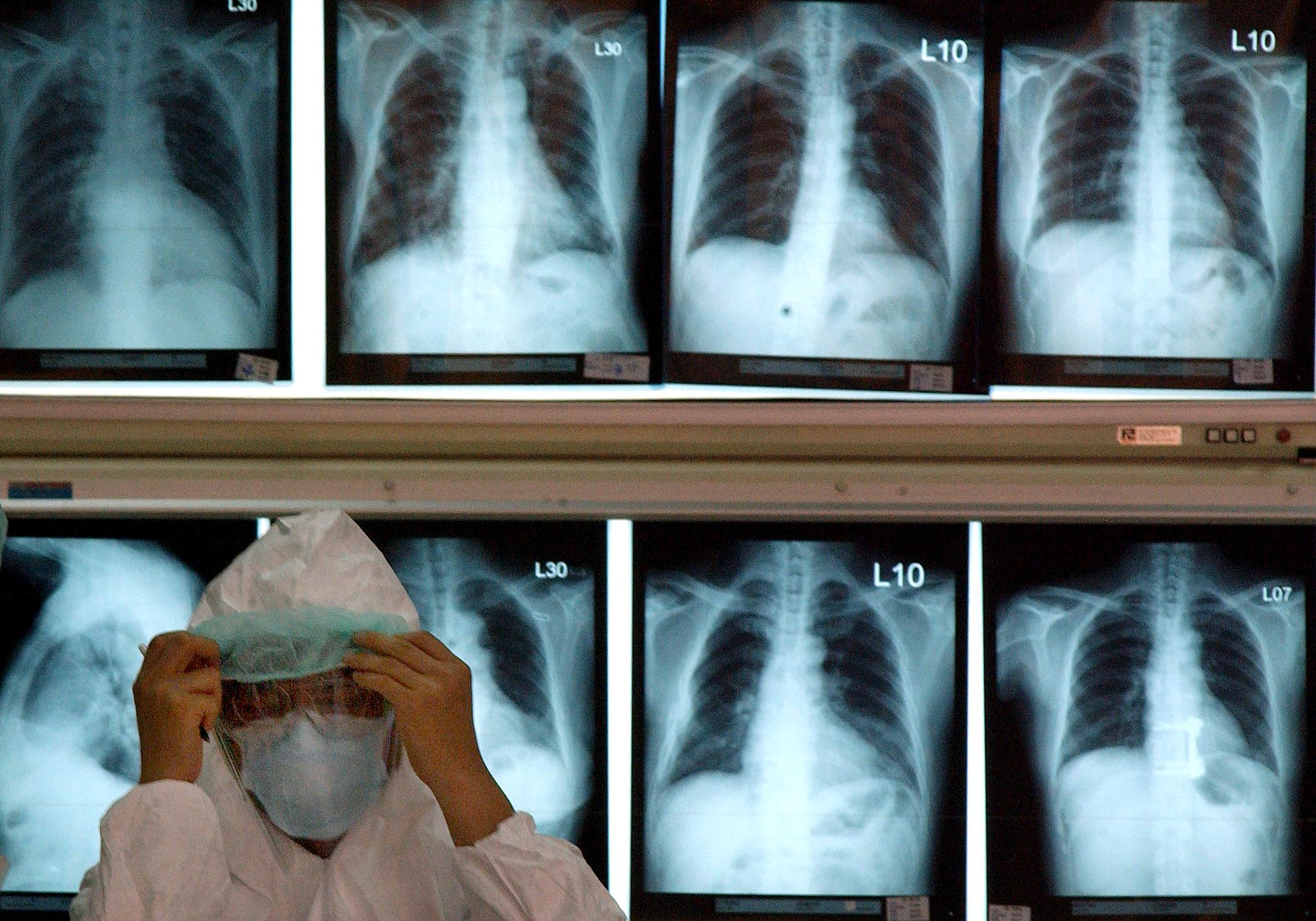Cancro matou quase 9 milhões de pessoas em todo o mundo em 2015