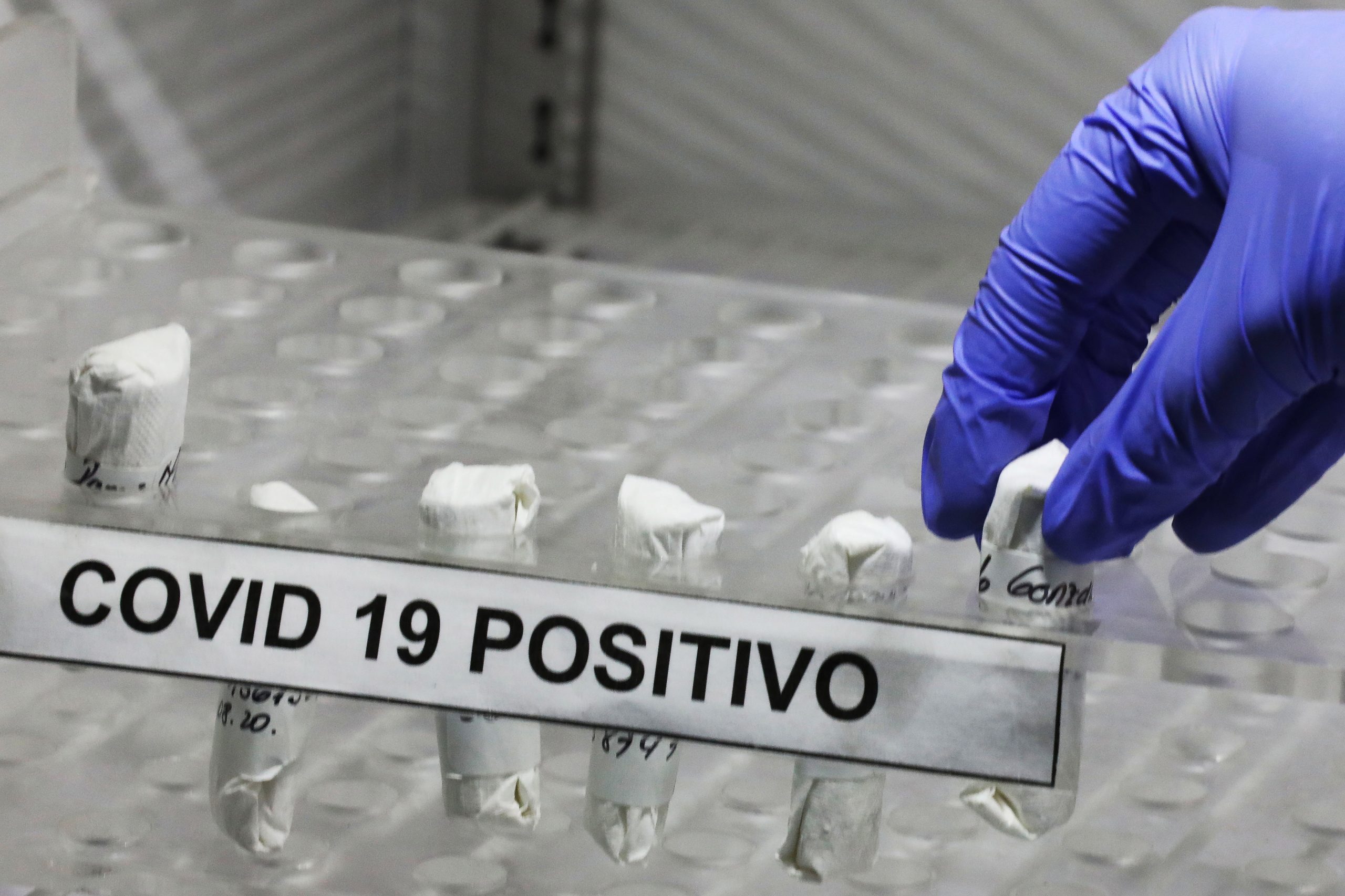 Covid-19: Morreram mais dois idosos de lar de Torres Vedras