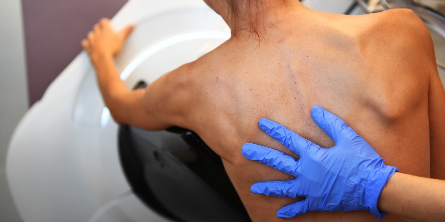 Tem mais de 45 anos? Será convocada para mamografia conforme itinerário das carrinhas de rastreio