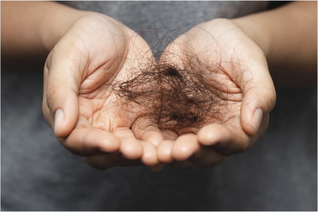 Mulheres afegãs desafiam talibãs e vendem cabelo para sobreviver